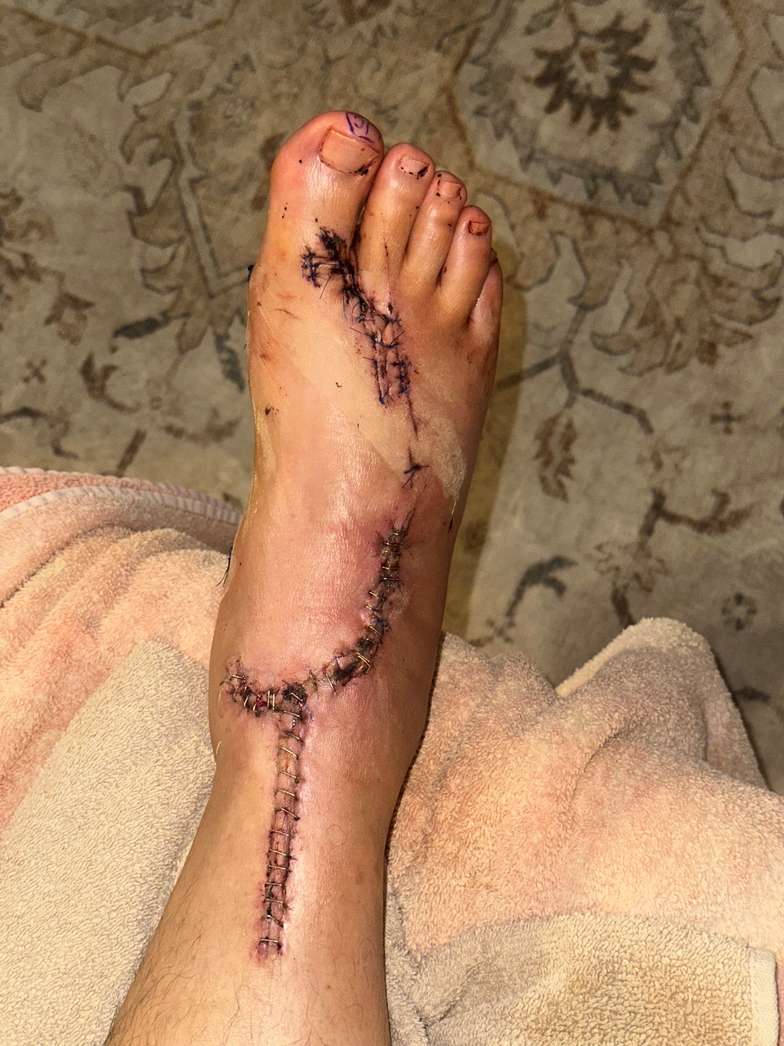 Help Dave Recover After Shark Attack campaign photo, 5 of 8