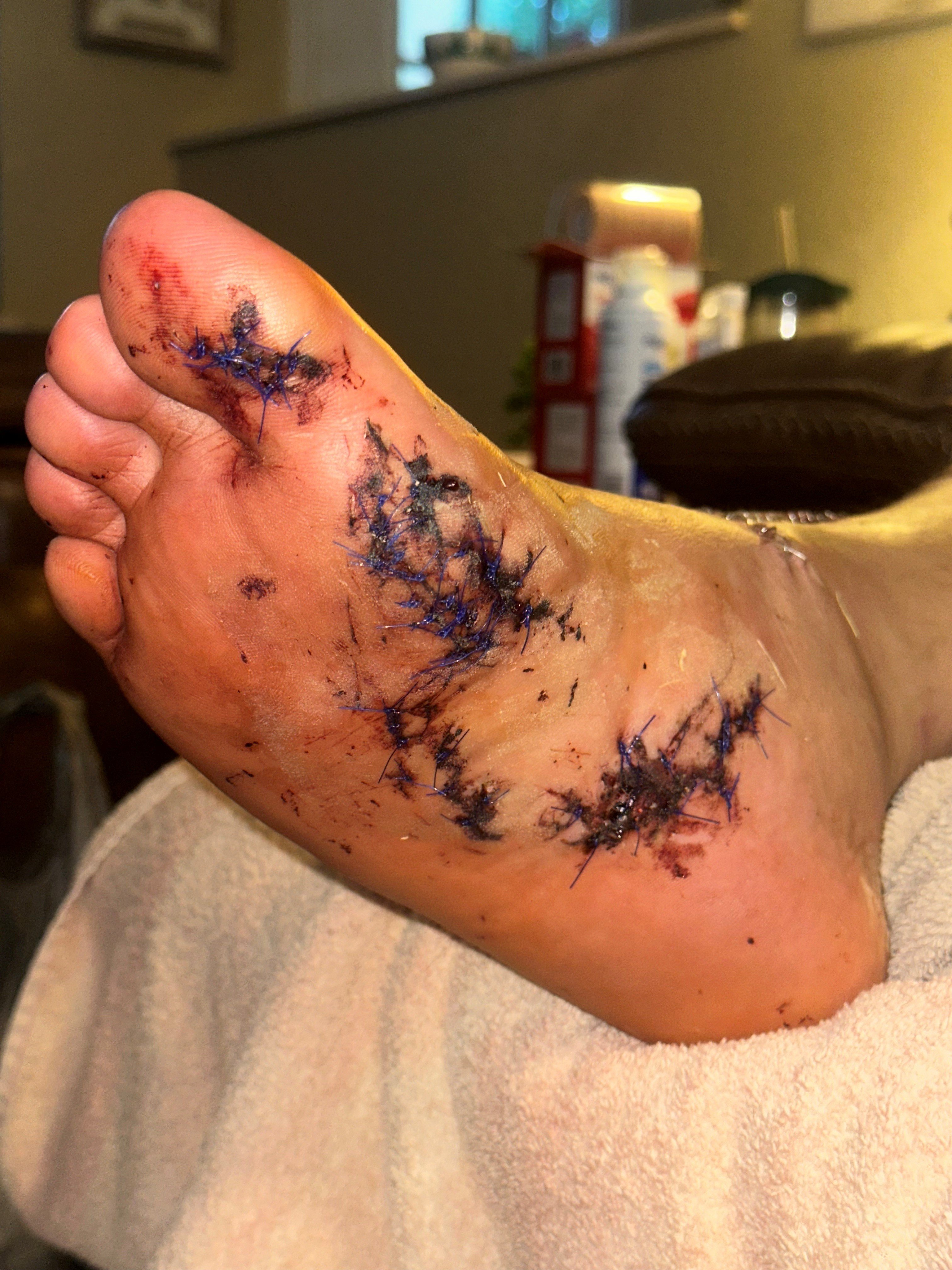 Help Dave Recover After Shark Attack campaign photo, 6 of 8