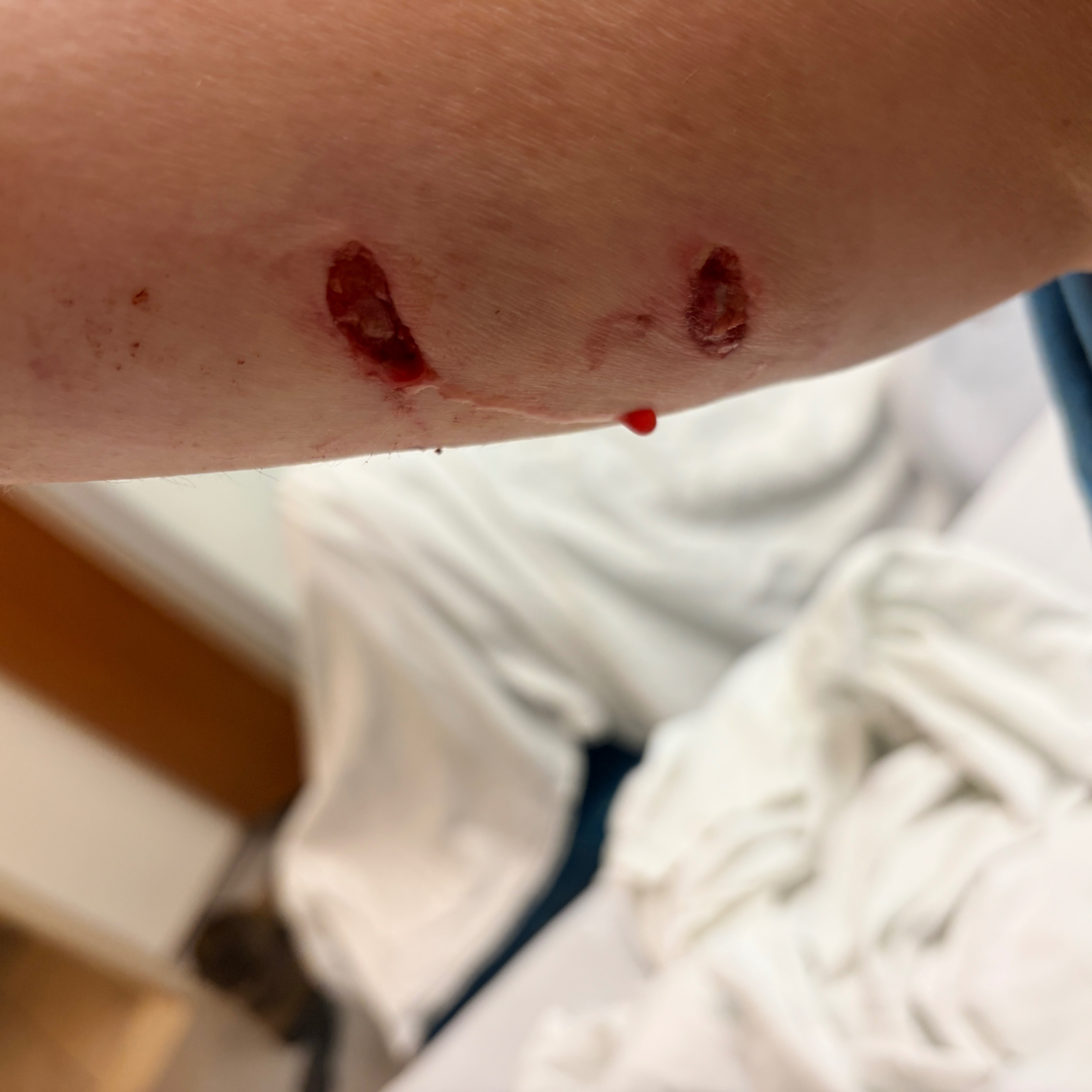 Support Courtenay’s Recovery After Dog Attack campaign photo, 7 of 8