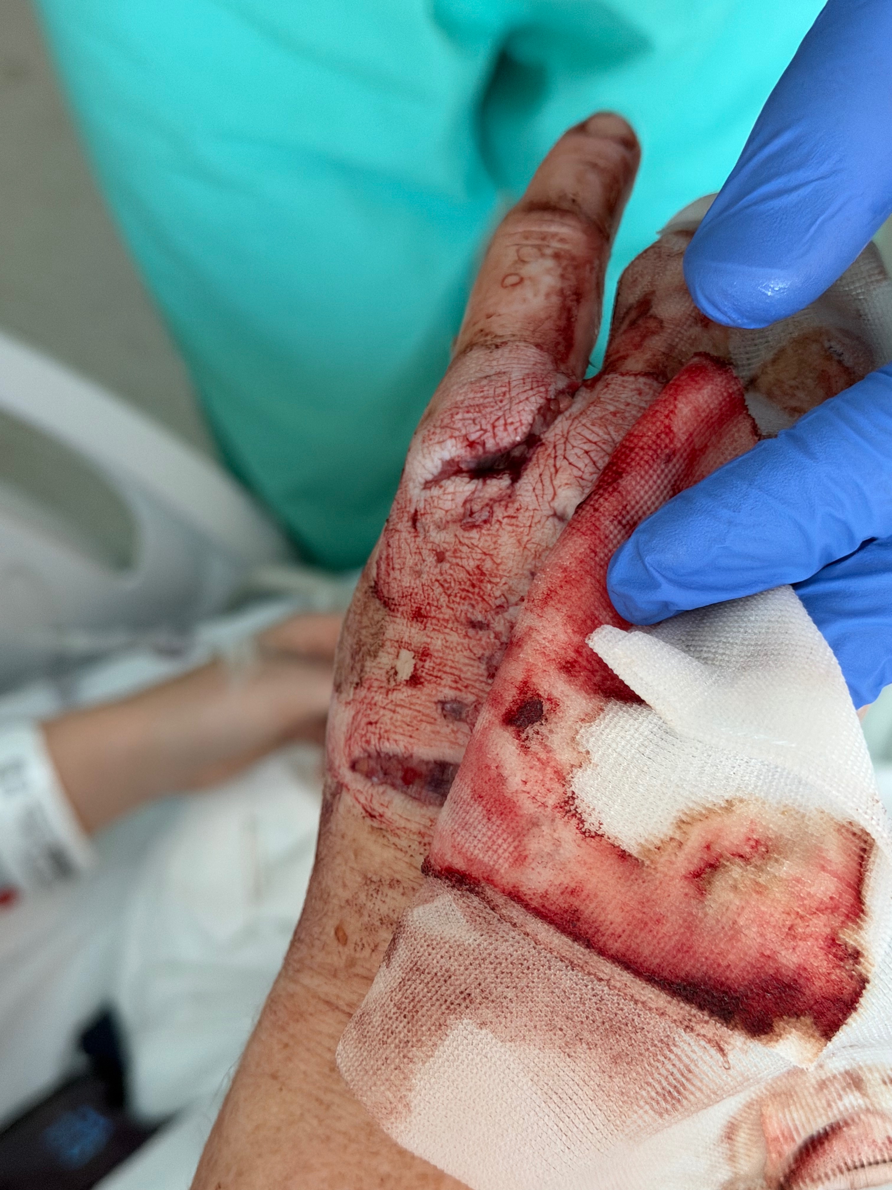 Support Courtenay’s Recovery After Dog Attack campaign photo, 4 of 8
