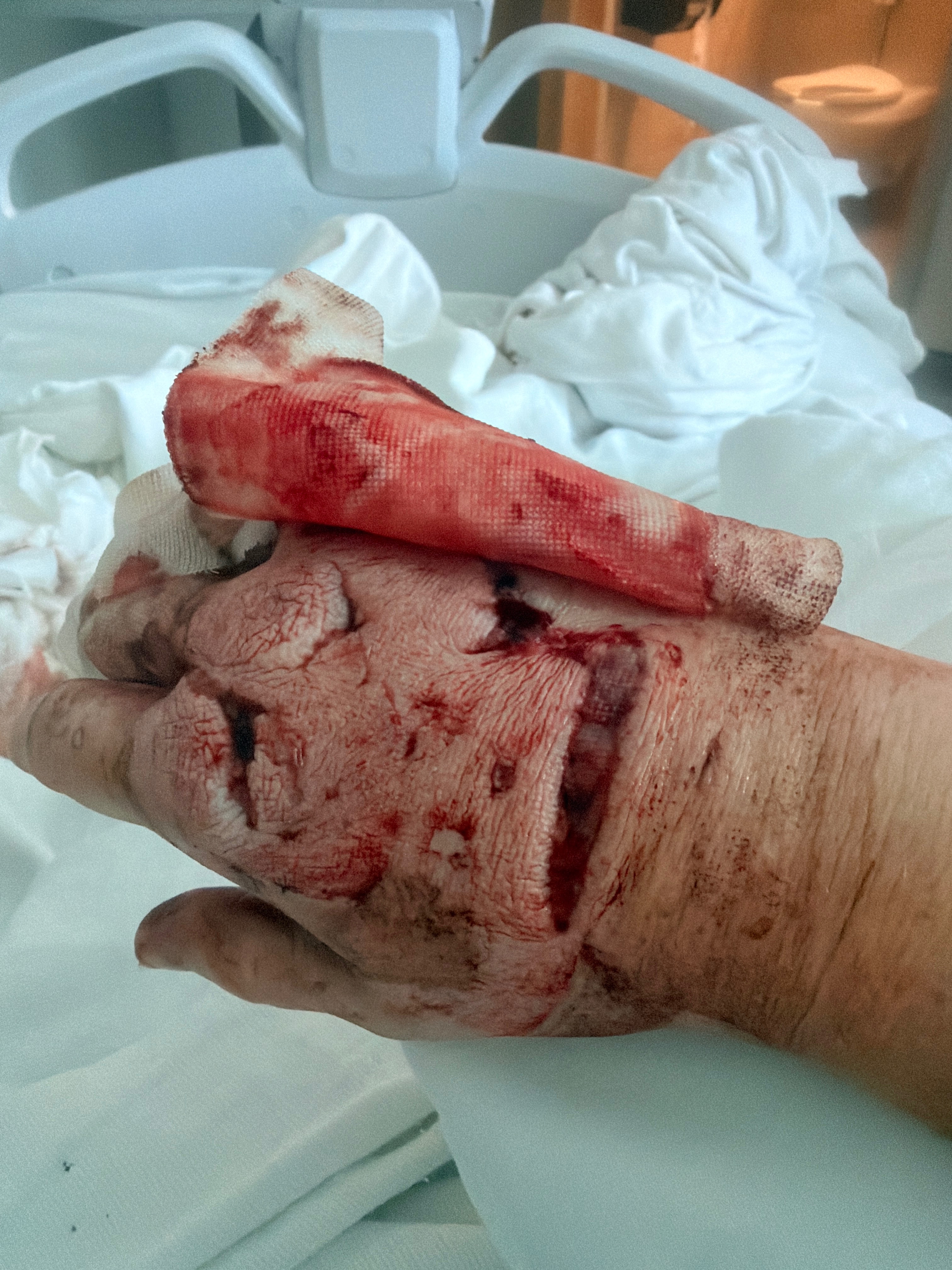 Support Courtenay’s Recovery After Dog Attack campaign photo, 5 of 8