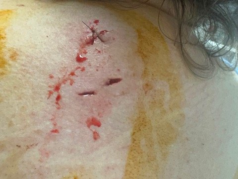 Support a Mum and Her Children After Melbourne CBD Attack campaign photo, 4 of 6