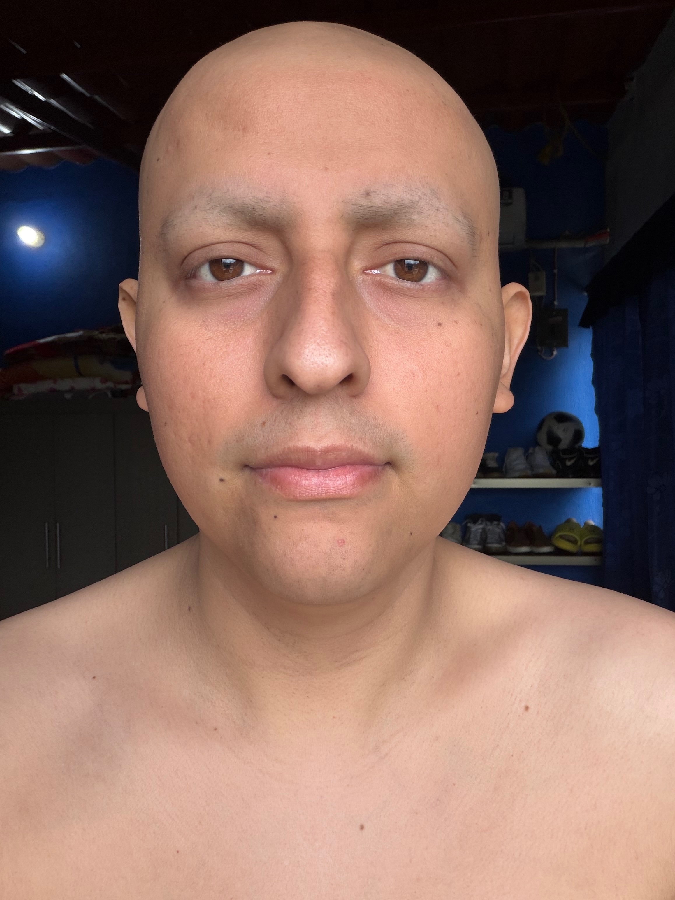 Segunda vez con cancer, ¡tú donativo puede salvarme! campaign photo, 2 of 8