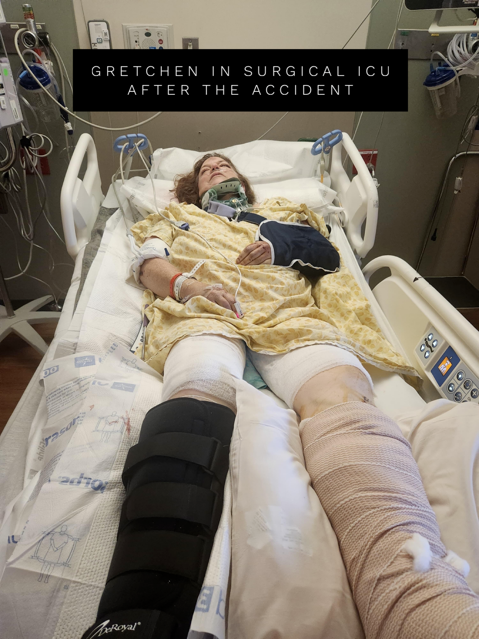 Her Brother Died in a Hit-and-Run. Years Later, She Was Hit. campaign photo, 2 of 8