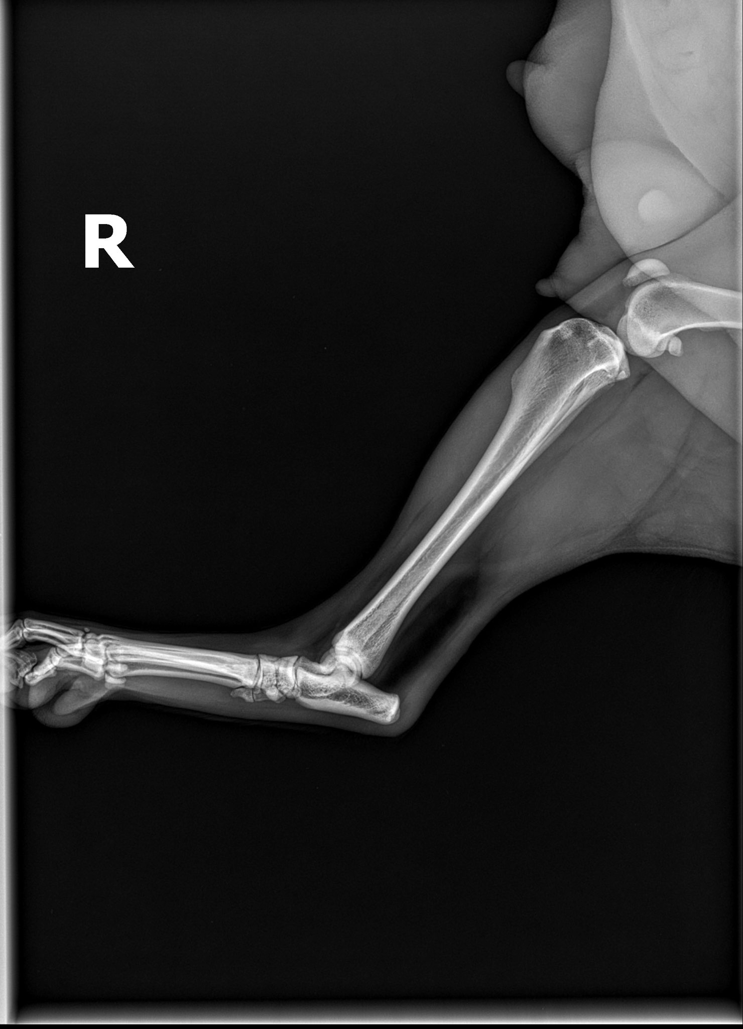 Save Mama Uno’s (Hasan from Devore) Leg from Amputation campaign photo, 12 of 13
