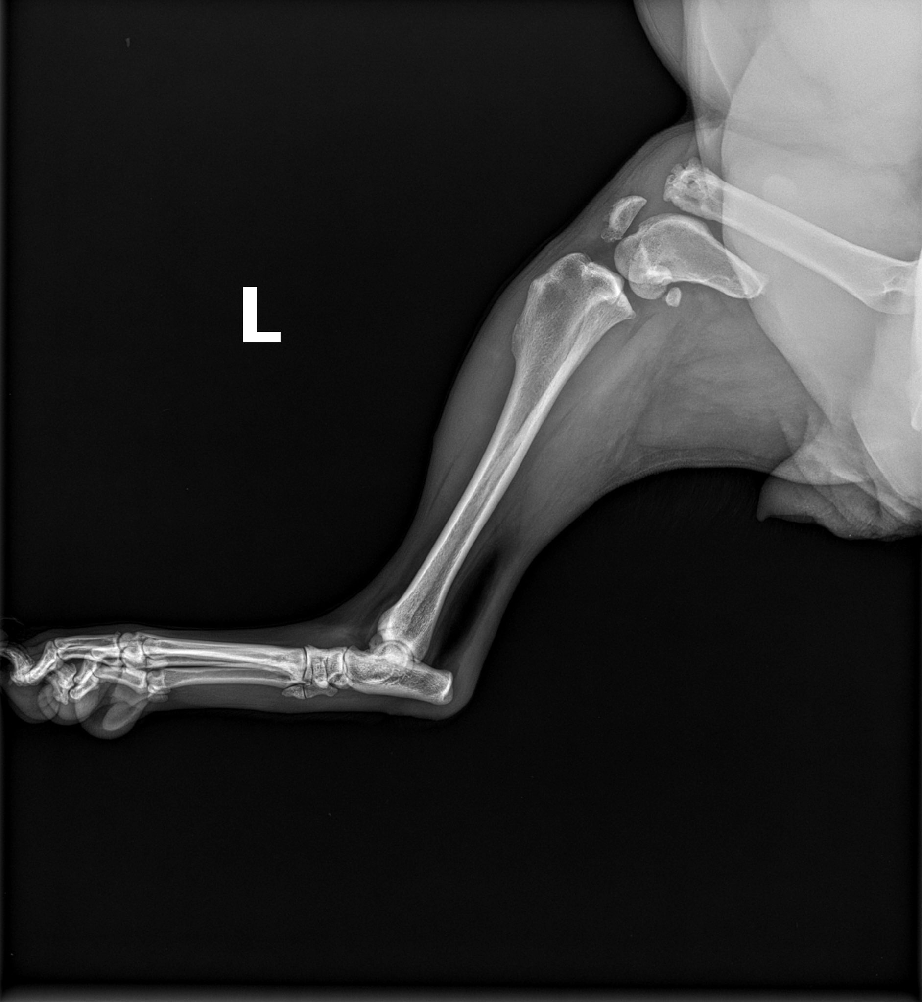 Save Mama Uno’s (Hasan from Devore) Leg from Amputation campaign photo, 2 of 13