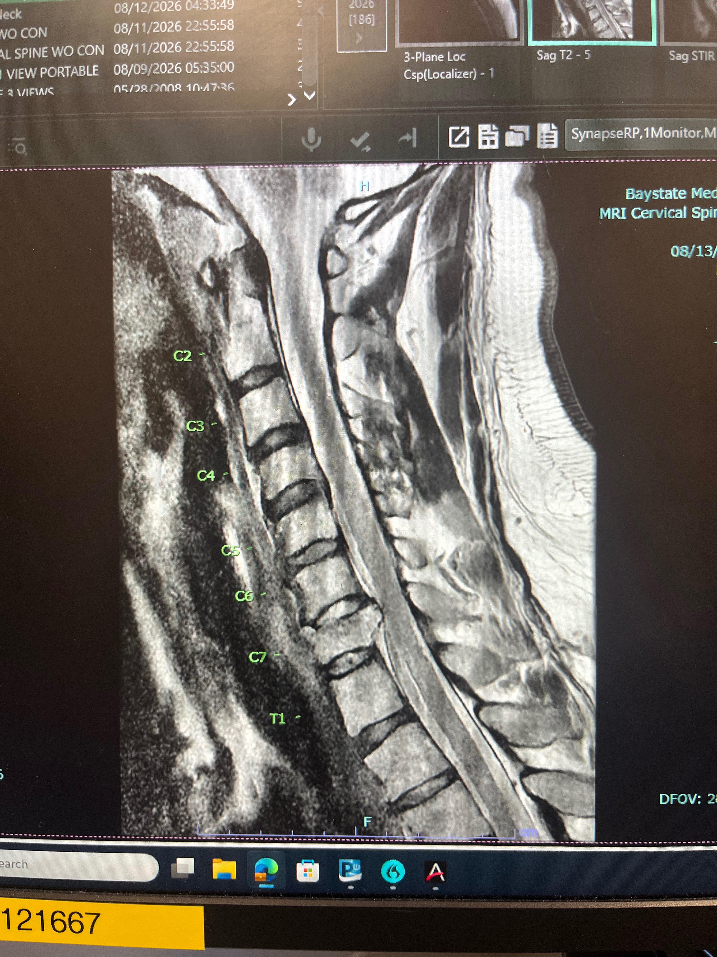 Support Levi through Neck Surgery & Recovery campaign photo, 2 of 5