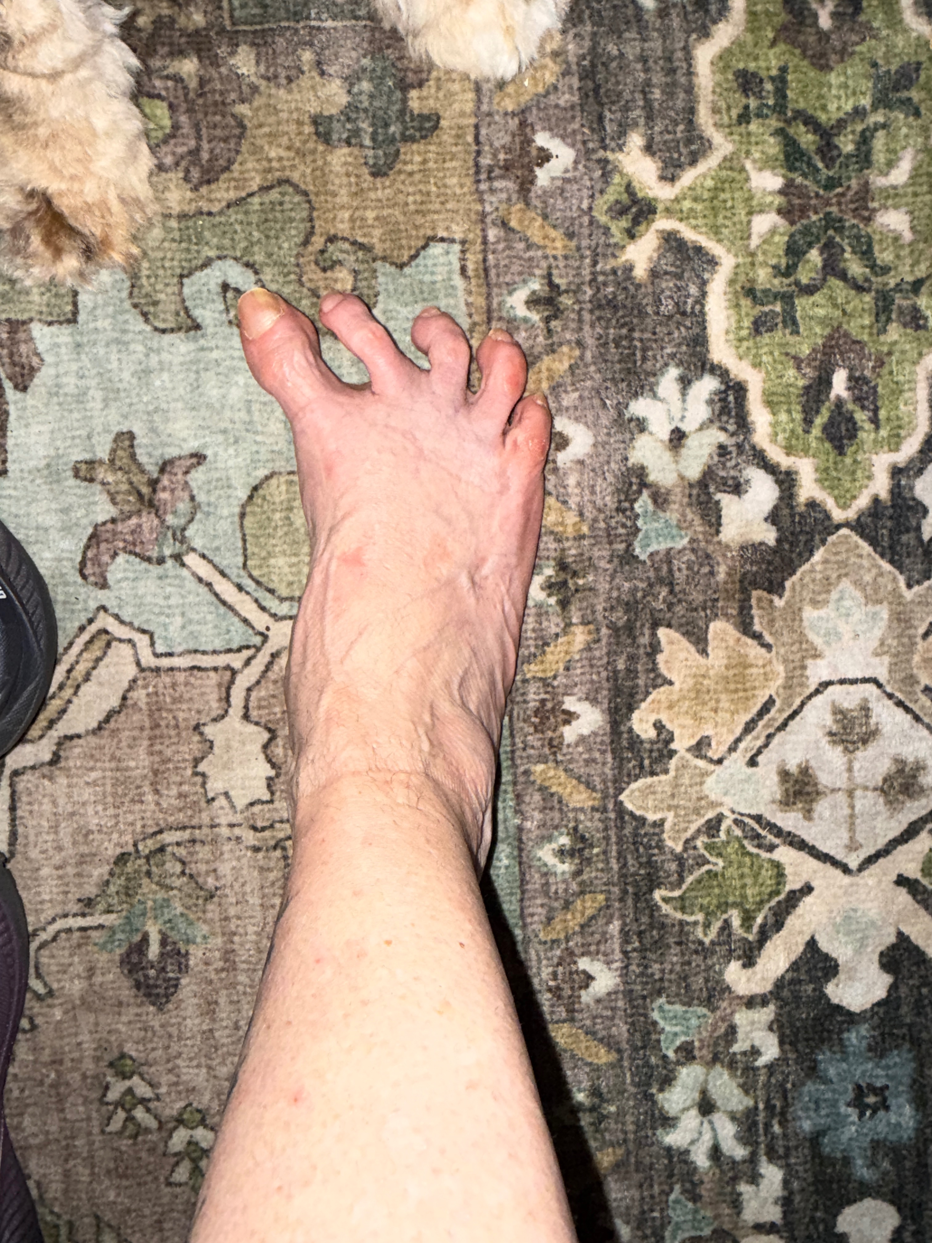 Help Ursula Recover From Foot Surgery campaign photo, 6 of 8