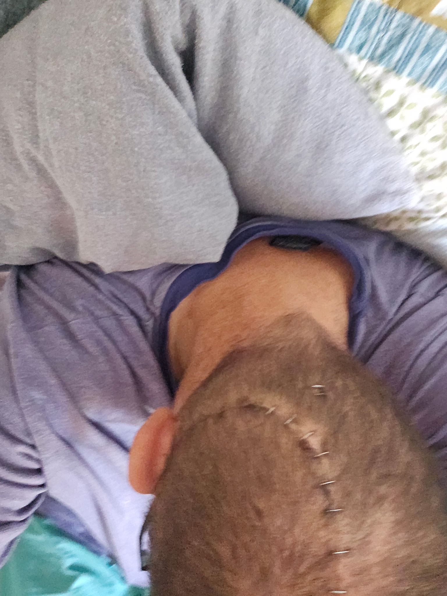 Help Chris Keep His Home After Surgery campaign photo, 6 of 7