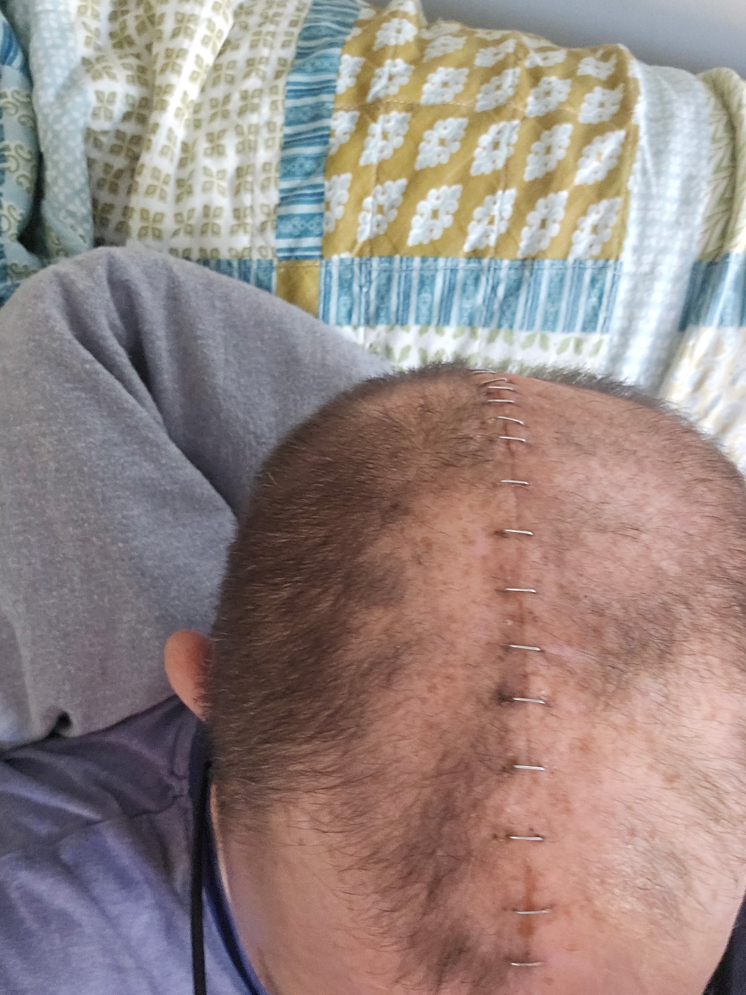 Help Chris Keep His Home After Surgery campaign photo, 2 of 7