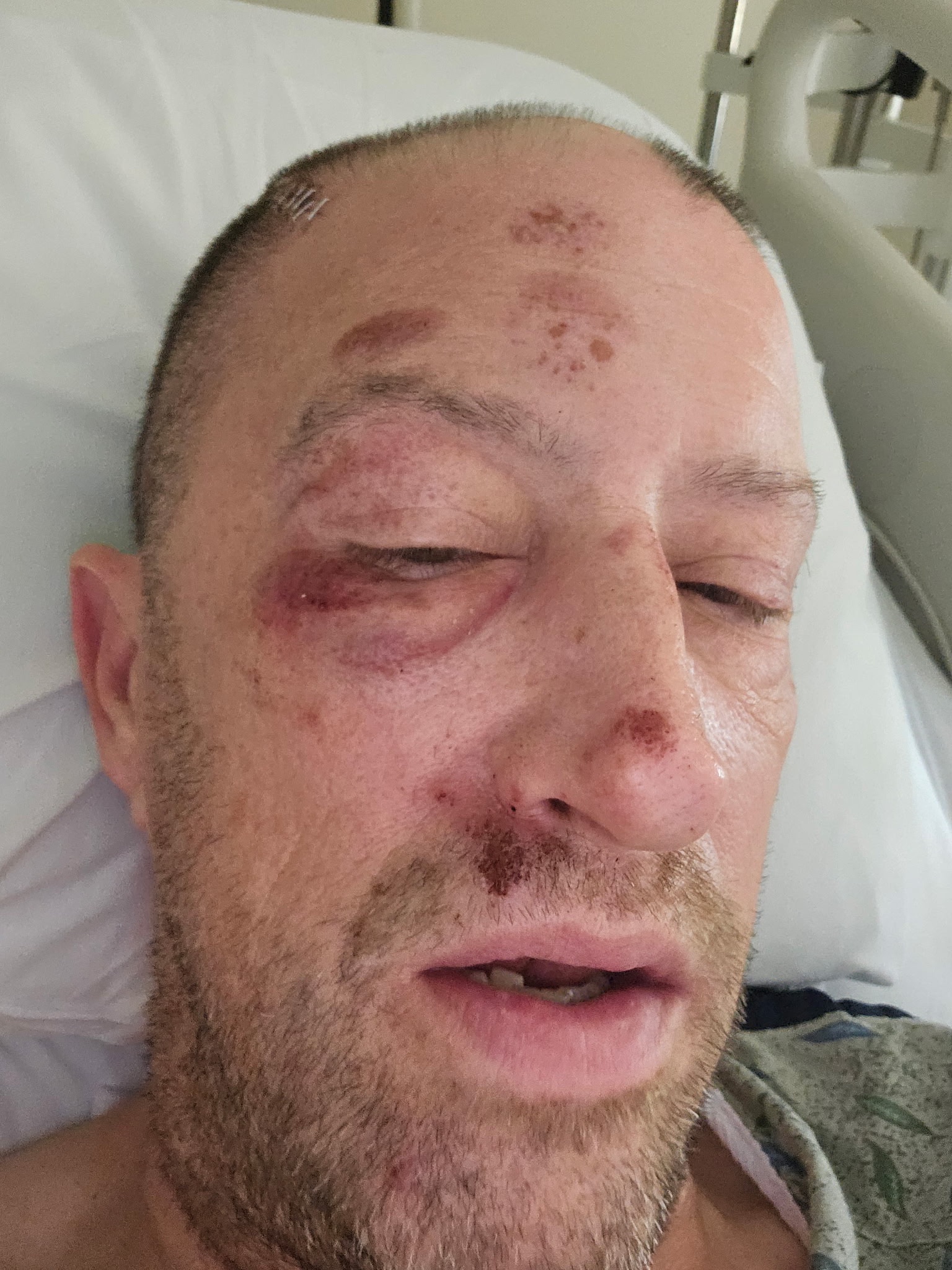 Help Chris Keep His Home After Surgery campaign photo, 5 of 7