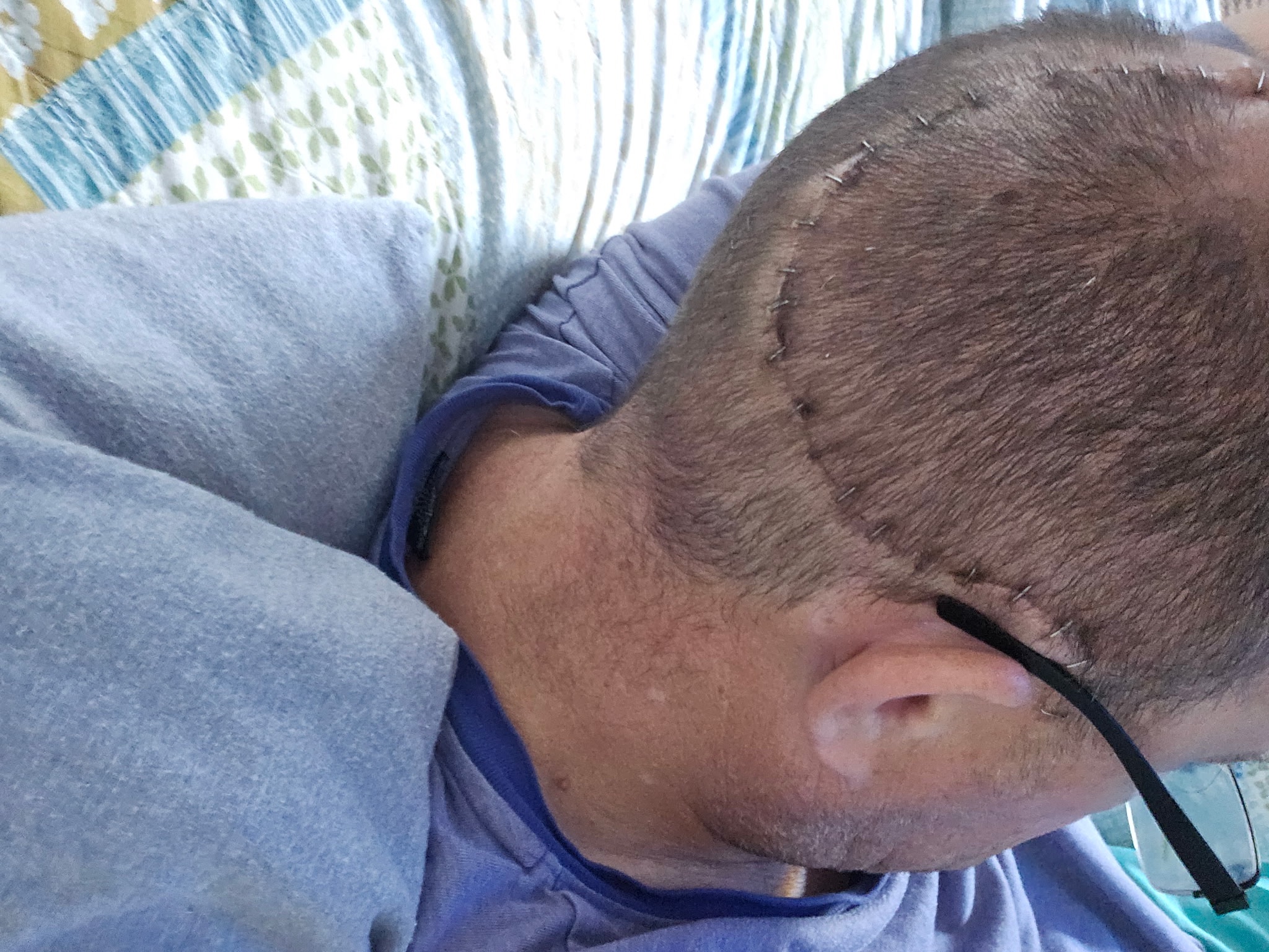Help Chris Keep His Home After Surgery campaign photo, 4 of 7
