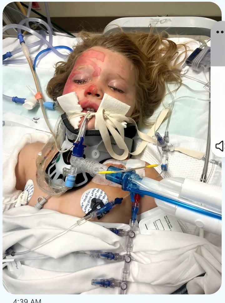 Support Nova and Jared's Burn Recovery campaign photo, 12 of 13