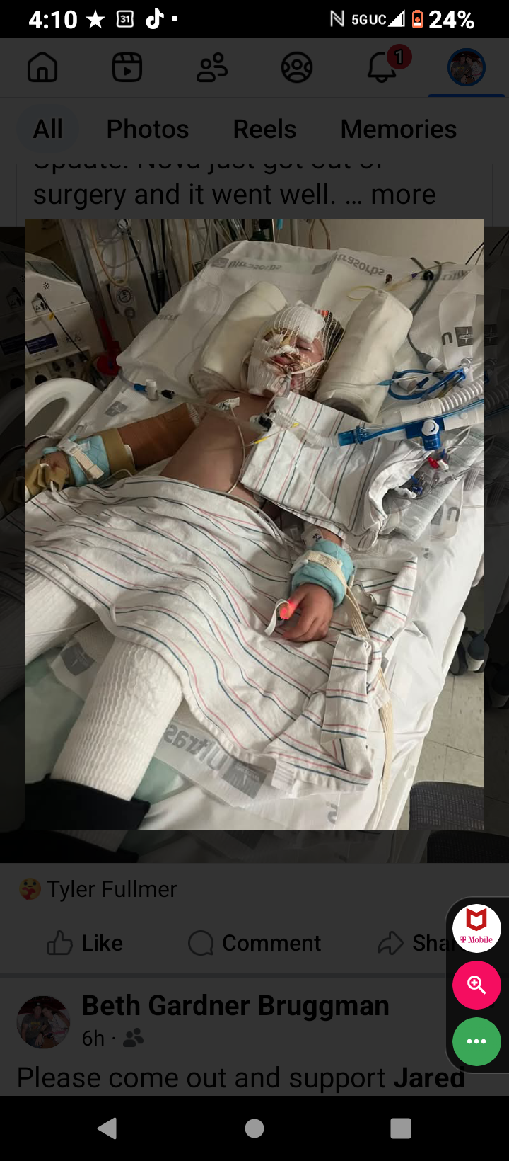 Support Nova and Jared's Burn Recovery campaign photo, 7 of 13