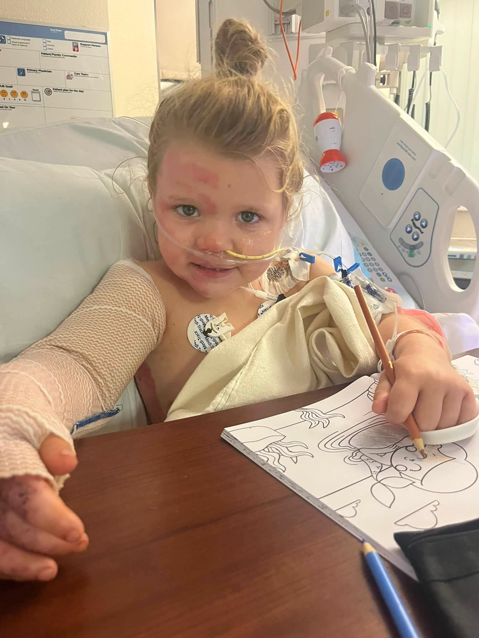 Support Nova and Jared's Burn Recovery campaign photo, 11 of 13