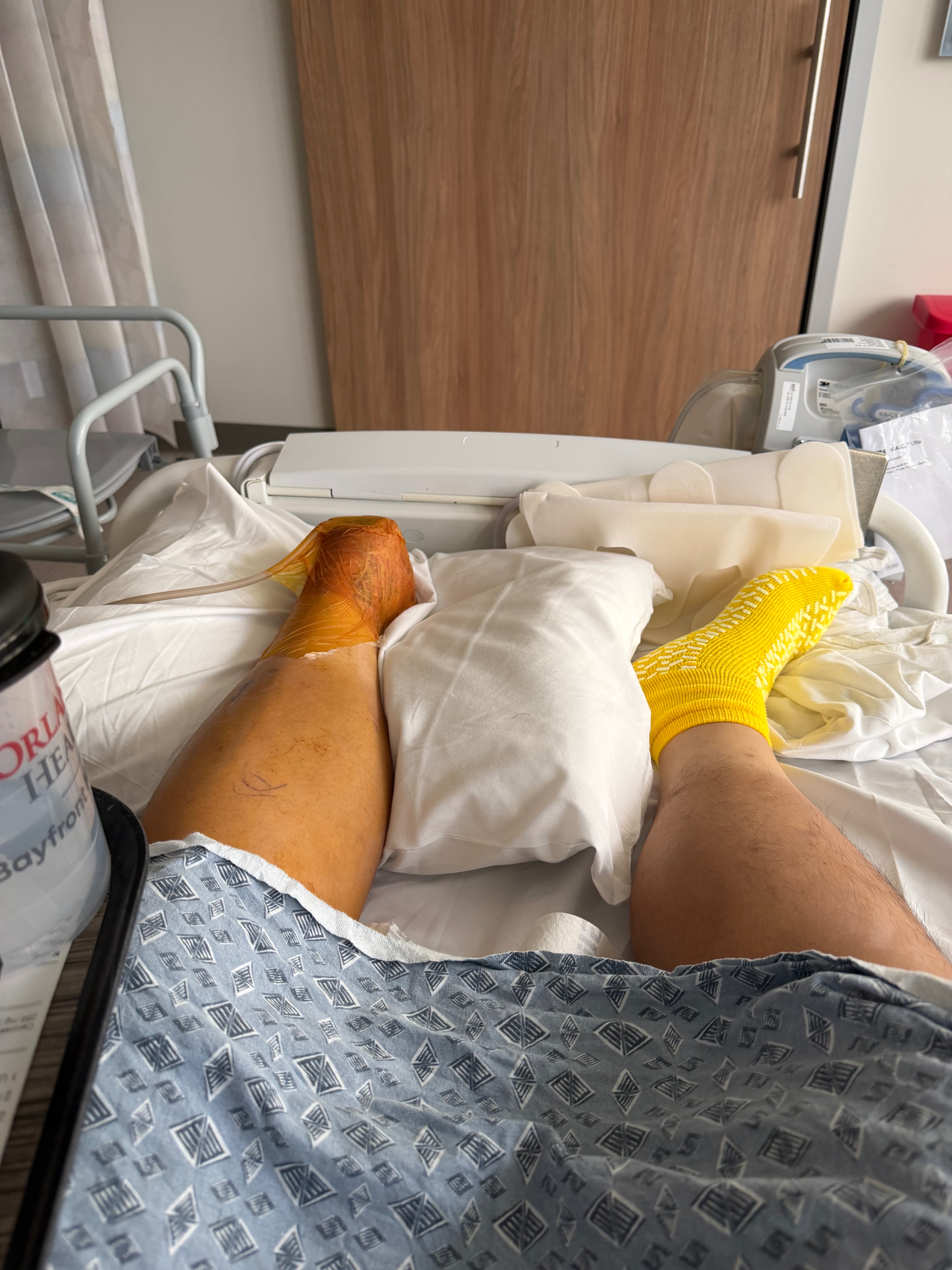 Help Adam Recover After Foot Amputation campaign photo, 7 of 8