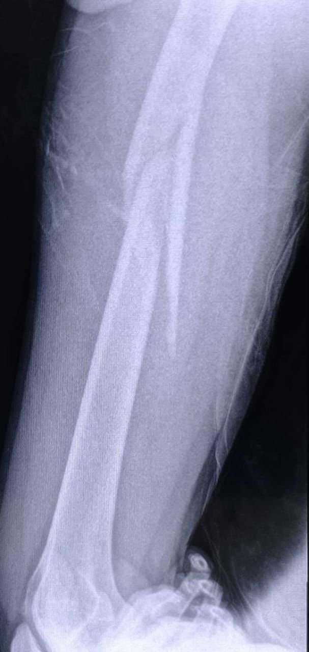 Help Rolando Cover Medical Costs After Surfing Injury campaign photo, 2 of 7