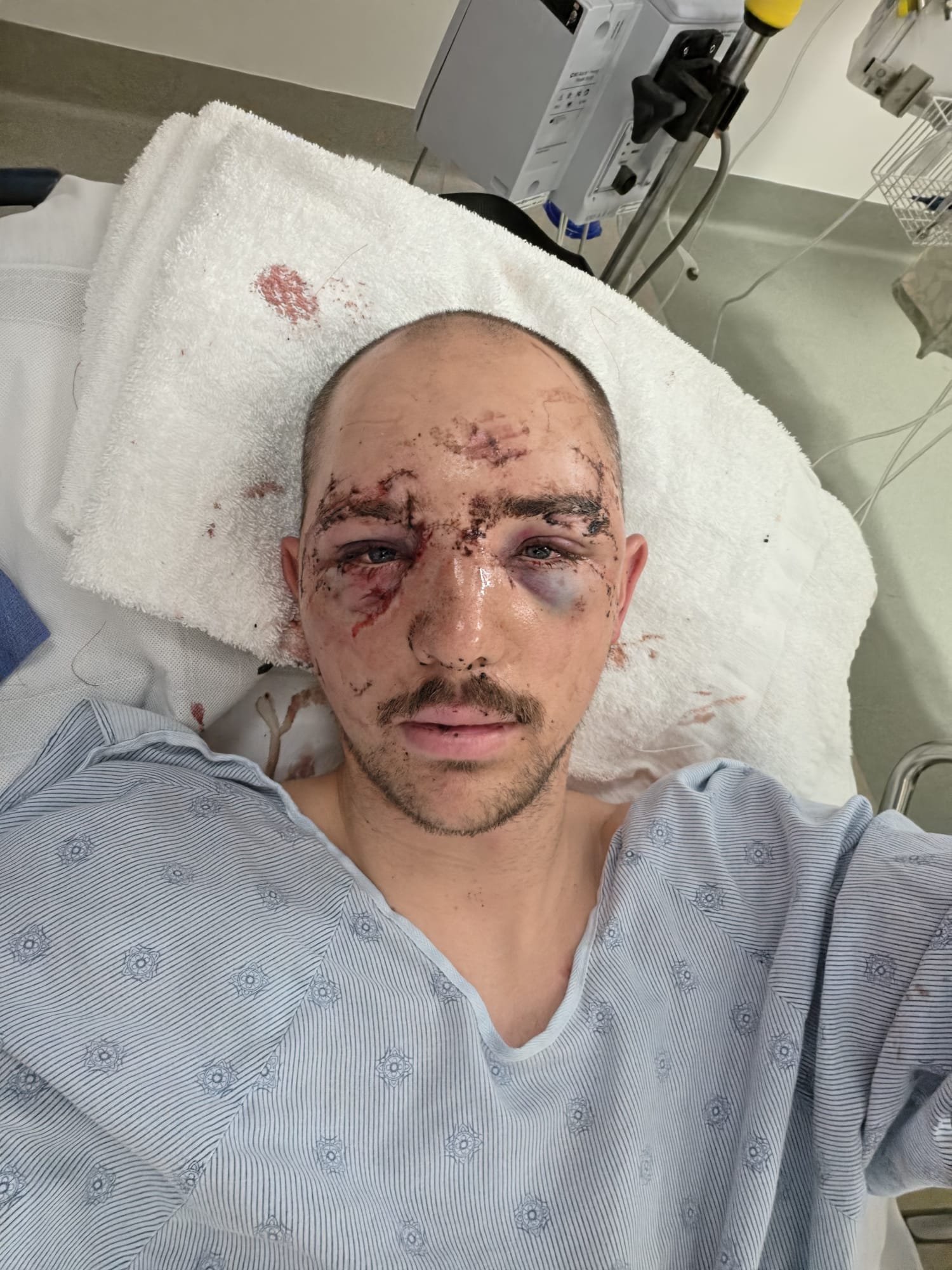 Supporting Jadon and Katie Nicoara after Bear Attack campaign photo, 2 of 5