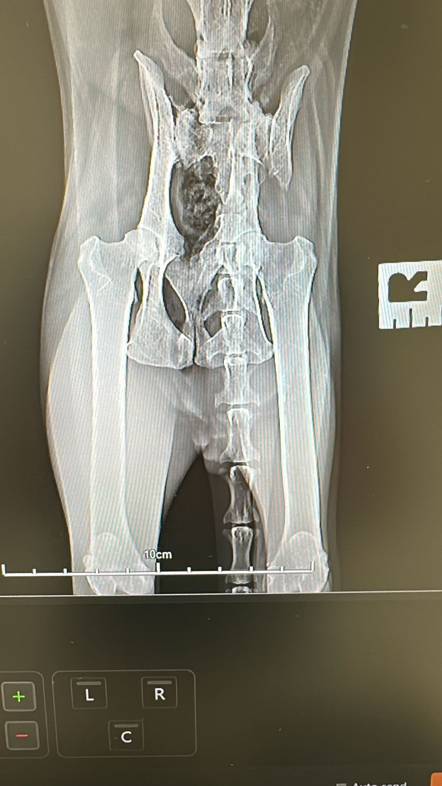 PLEASE DON’T LET AYAN DIE — HIS SURGERY CANNOT WAIT campaign photo, 2 of 8