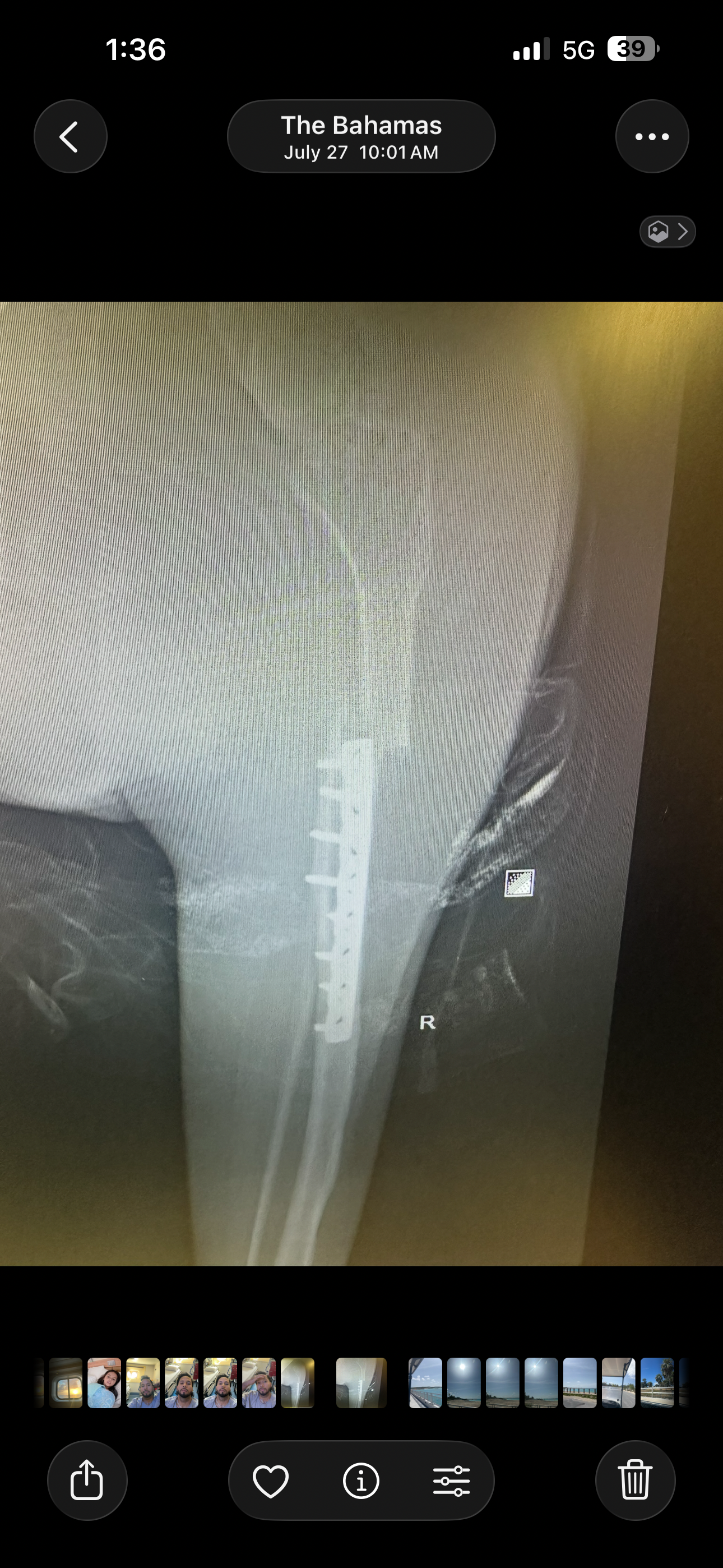 Foto della campagna Cristian's Recovery After Emergency Surgery, 5 di 7
