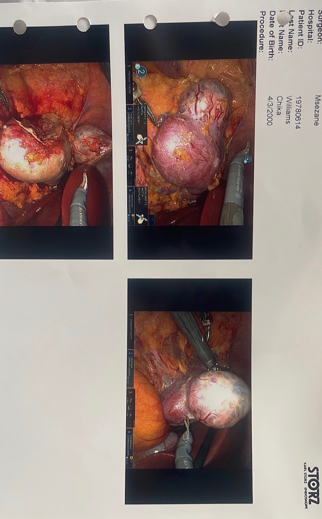 Help Chika Beat Cancer- Surgery No.4 & Restart Immunotherapy campaign photo, 6 of 8