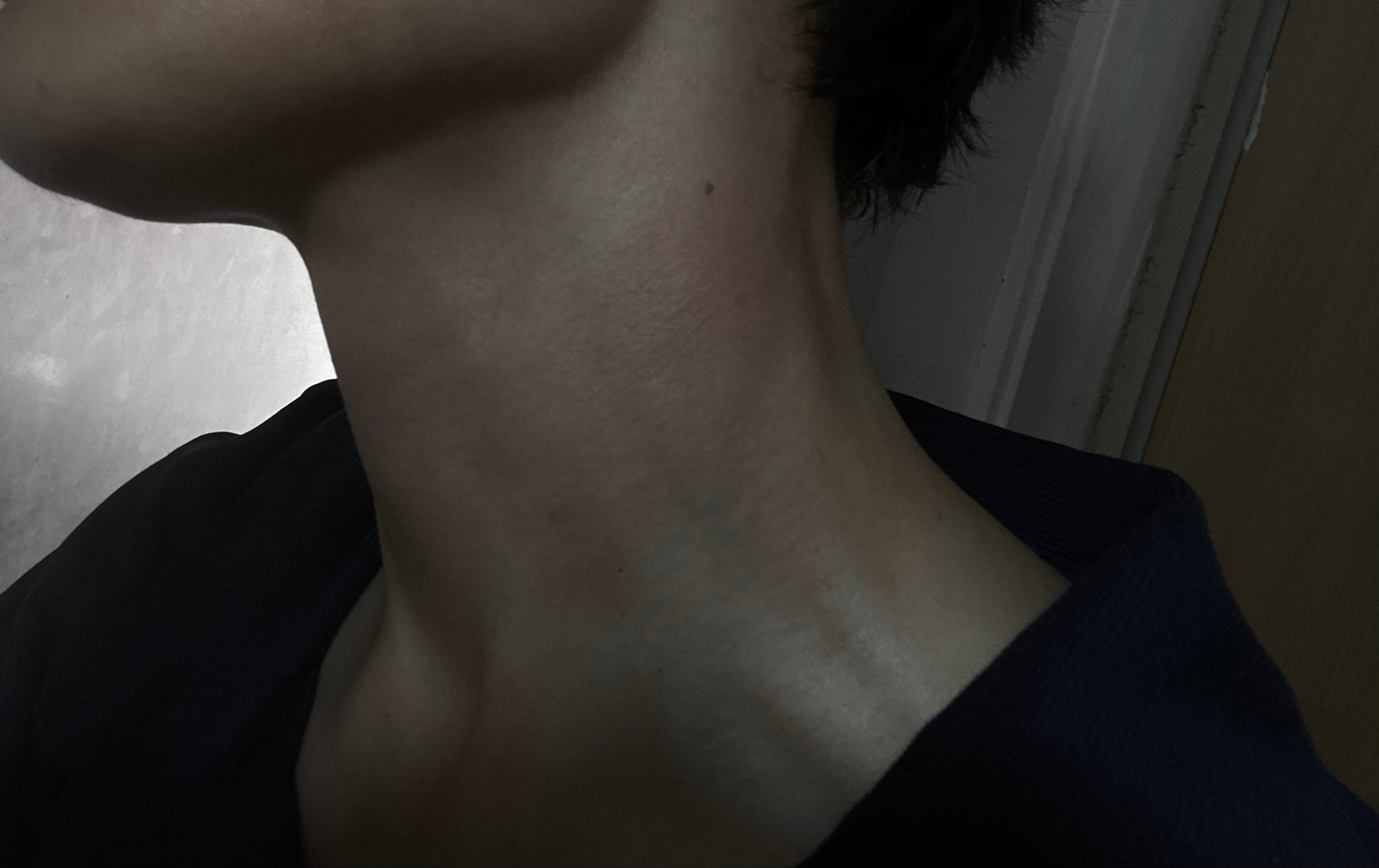 Lesbian Refugee Survivor of Homophobic Police Brutality campaign photo, 7 of 8