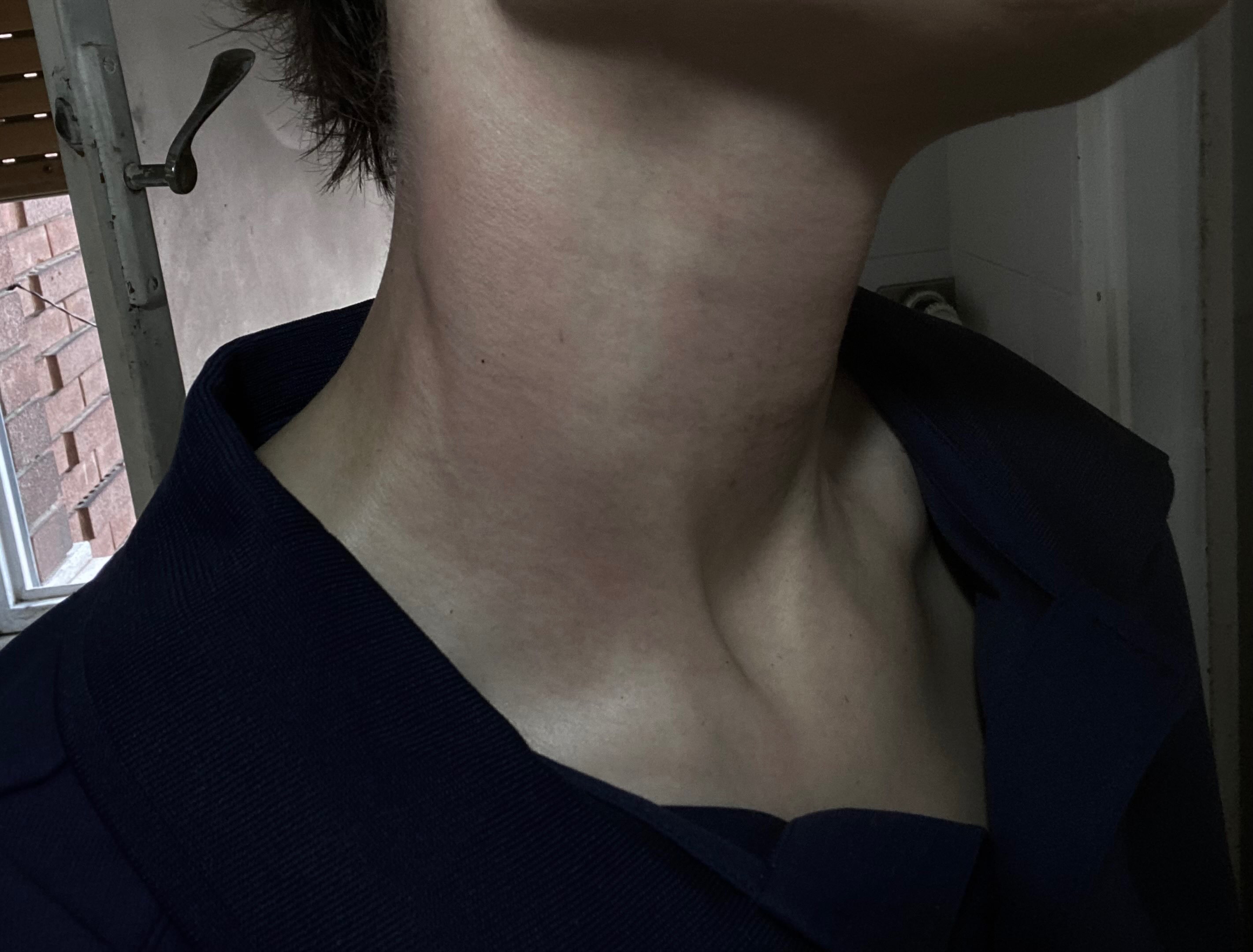 Lesbian Refugee Survivor of Homophobic Police Brutality campaign photo, 6 of 8