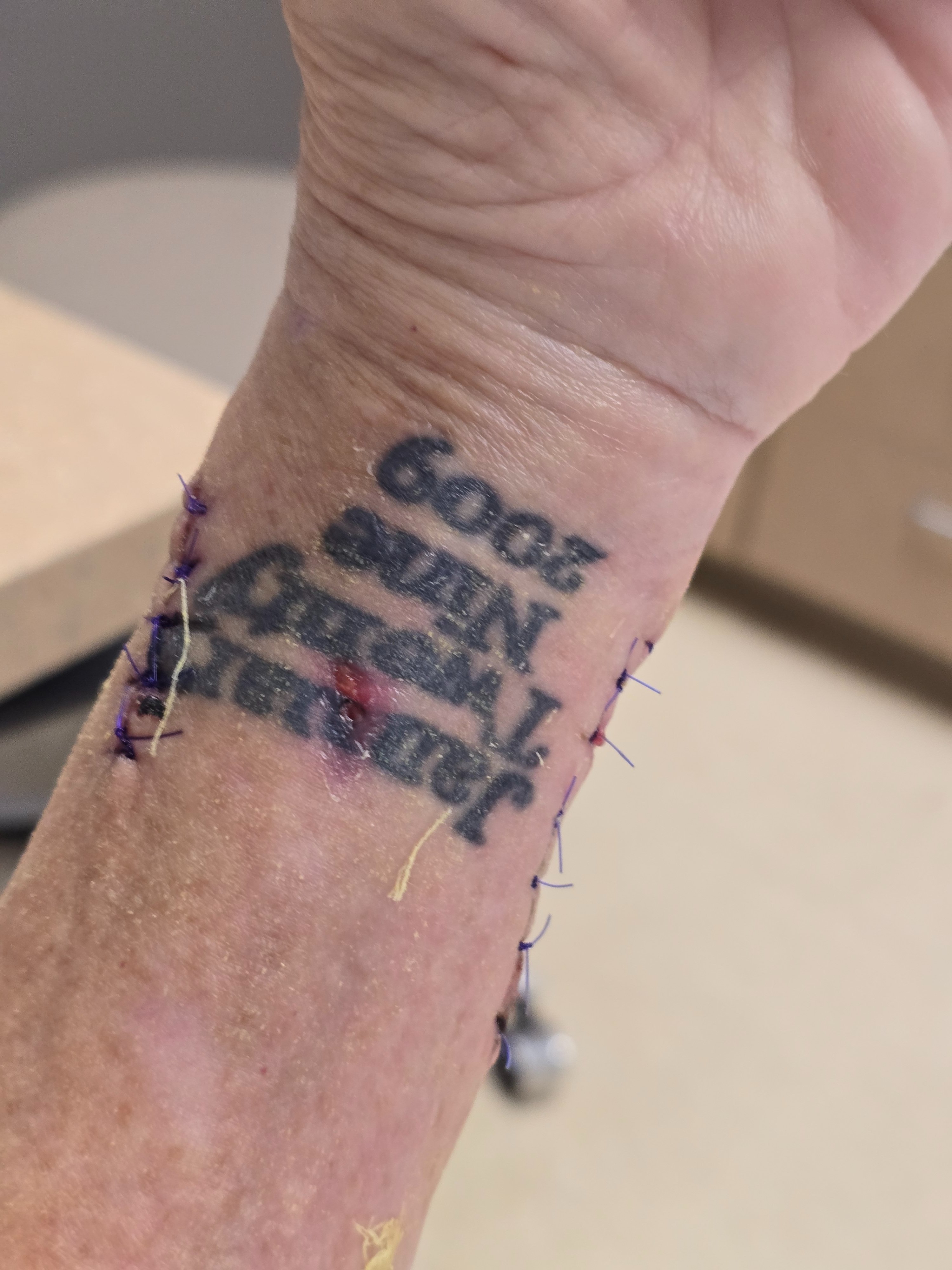 Help Angela Heal After Rare Infection campaign photo, 6 of 7