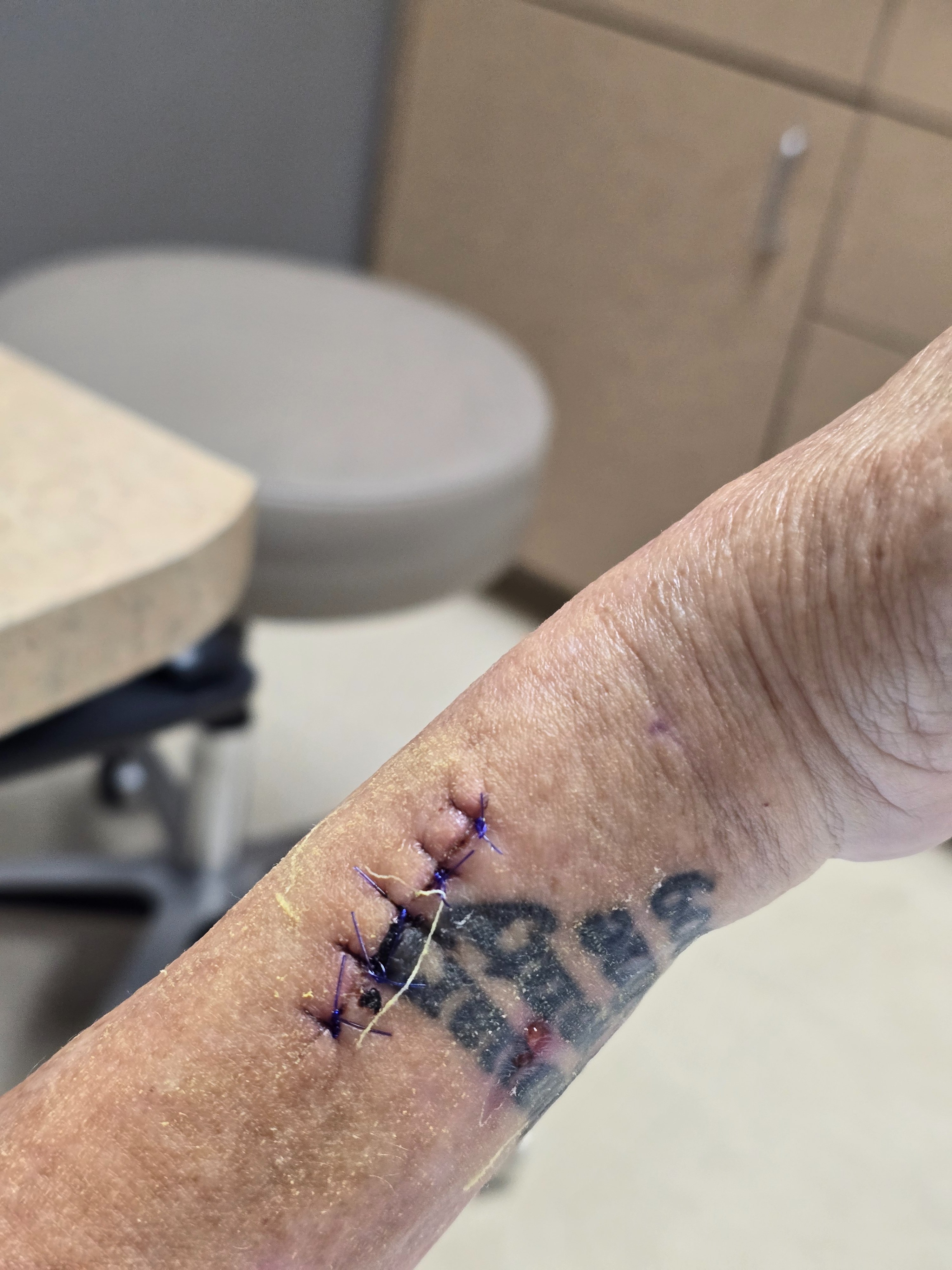 Help Angela Heal After Rare Infection campaign photo, 2 of 7