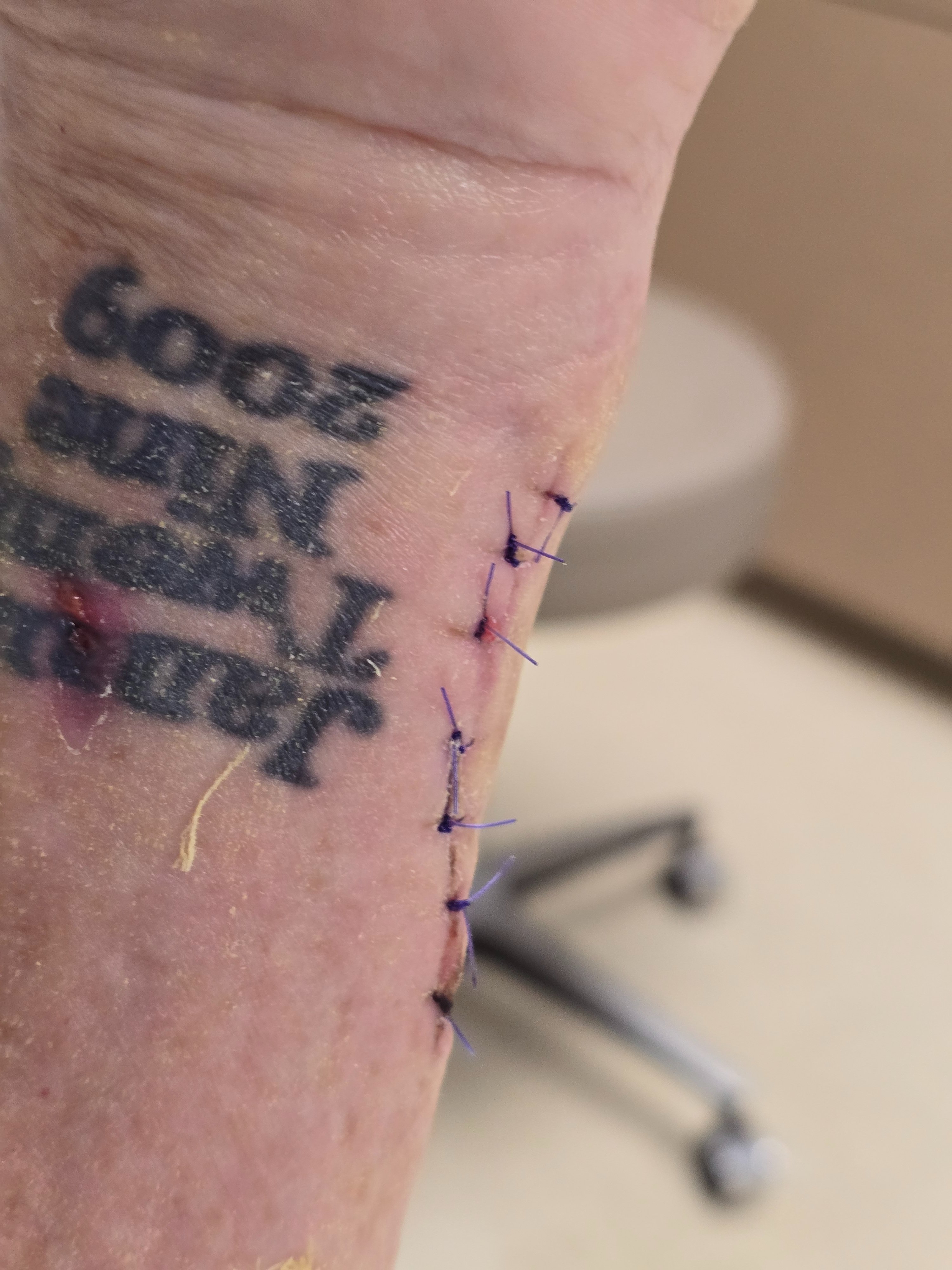 Help Angela Heal After Rare Infection campaign photo, 4 of 7