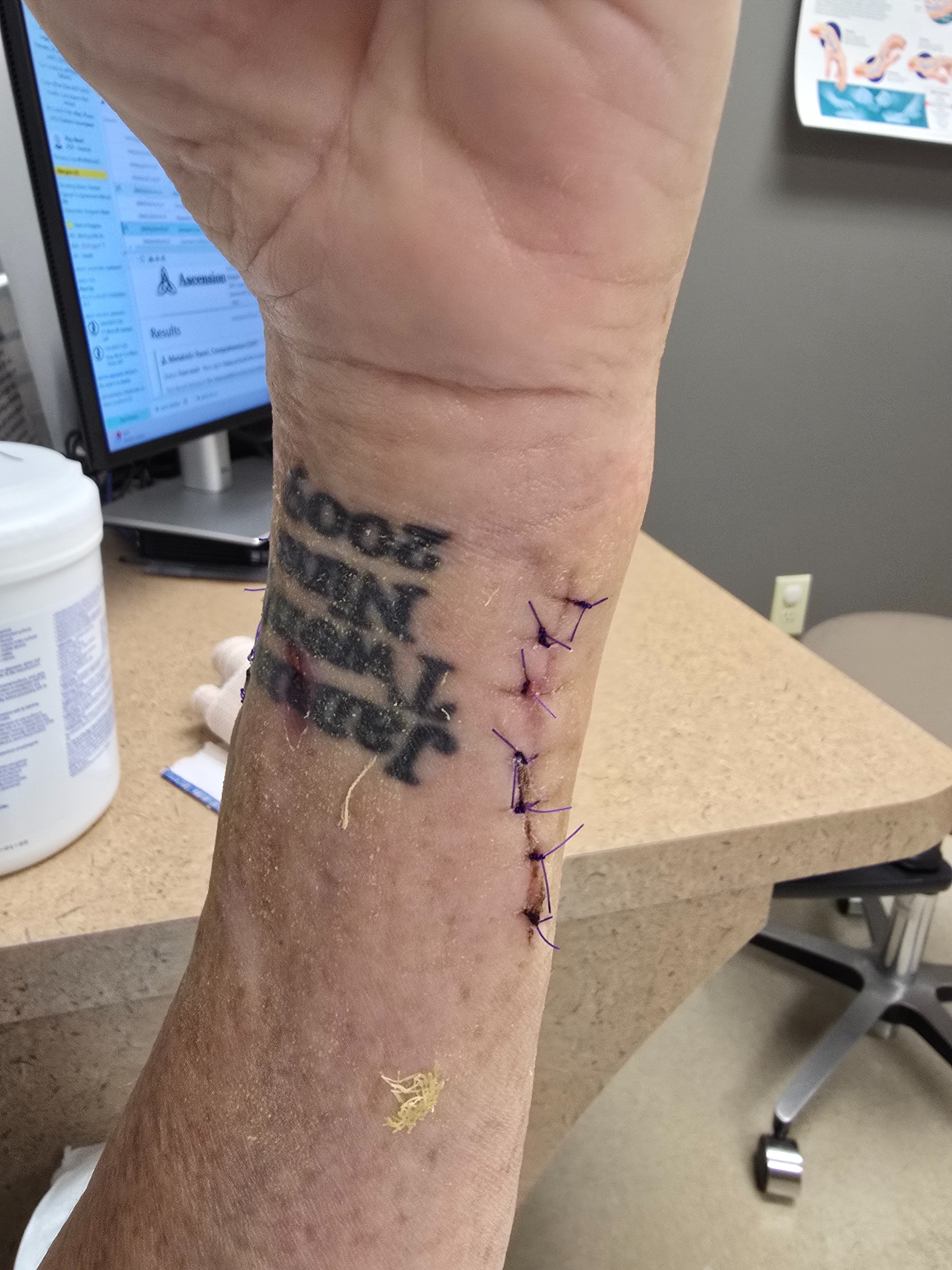 Help Angela Heal After Rare Infection campaign photo, 5 of 7