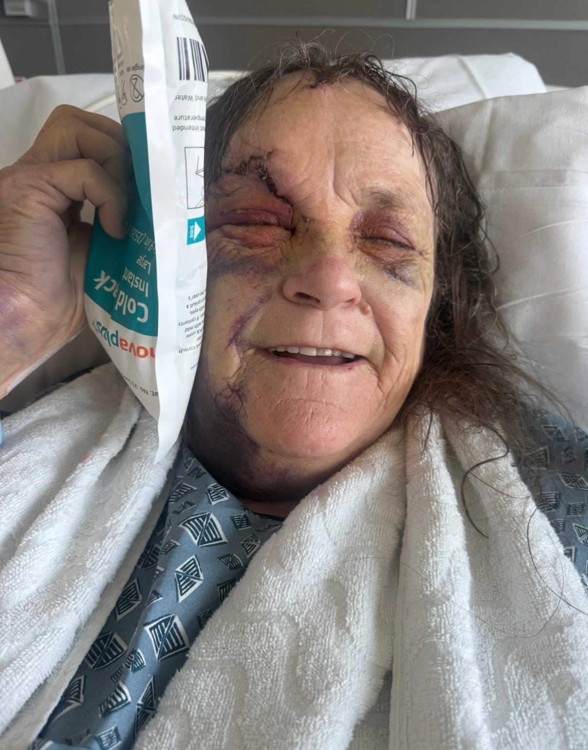 Help My Mom Recover from a Brutal Attack campaign photo, 5 of 7