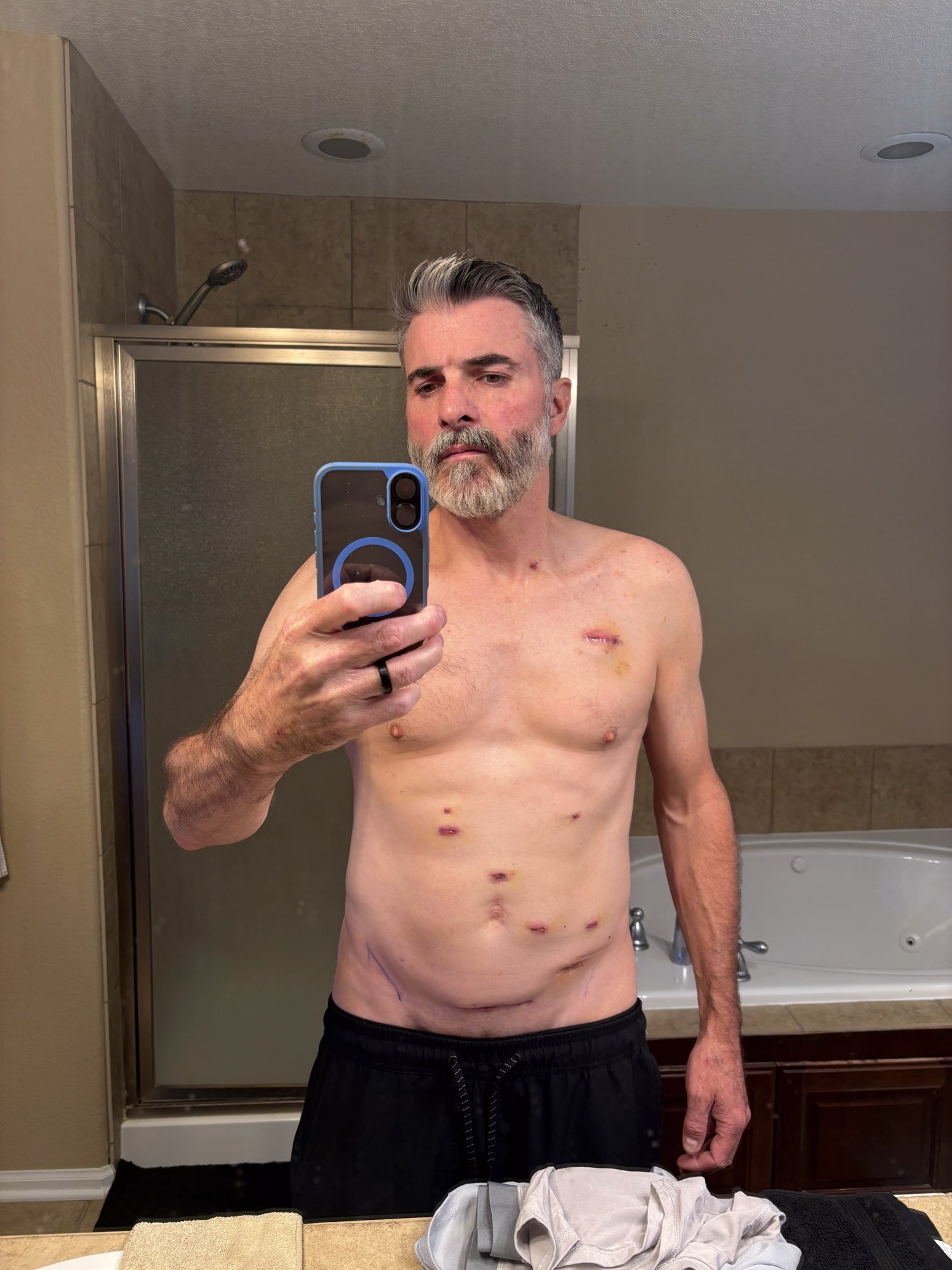 Support Our Brother Mark Critchfield's Fight Against Cancer campaign photo, 5 of 8