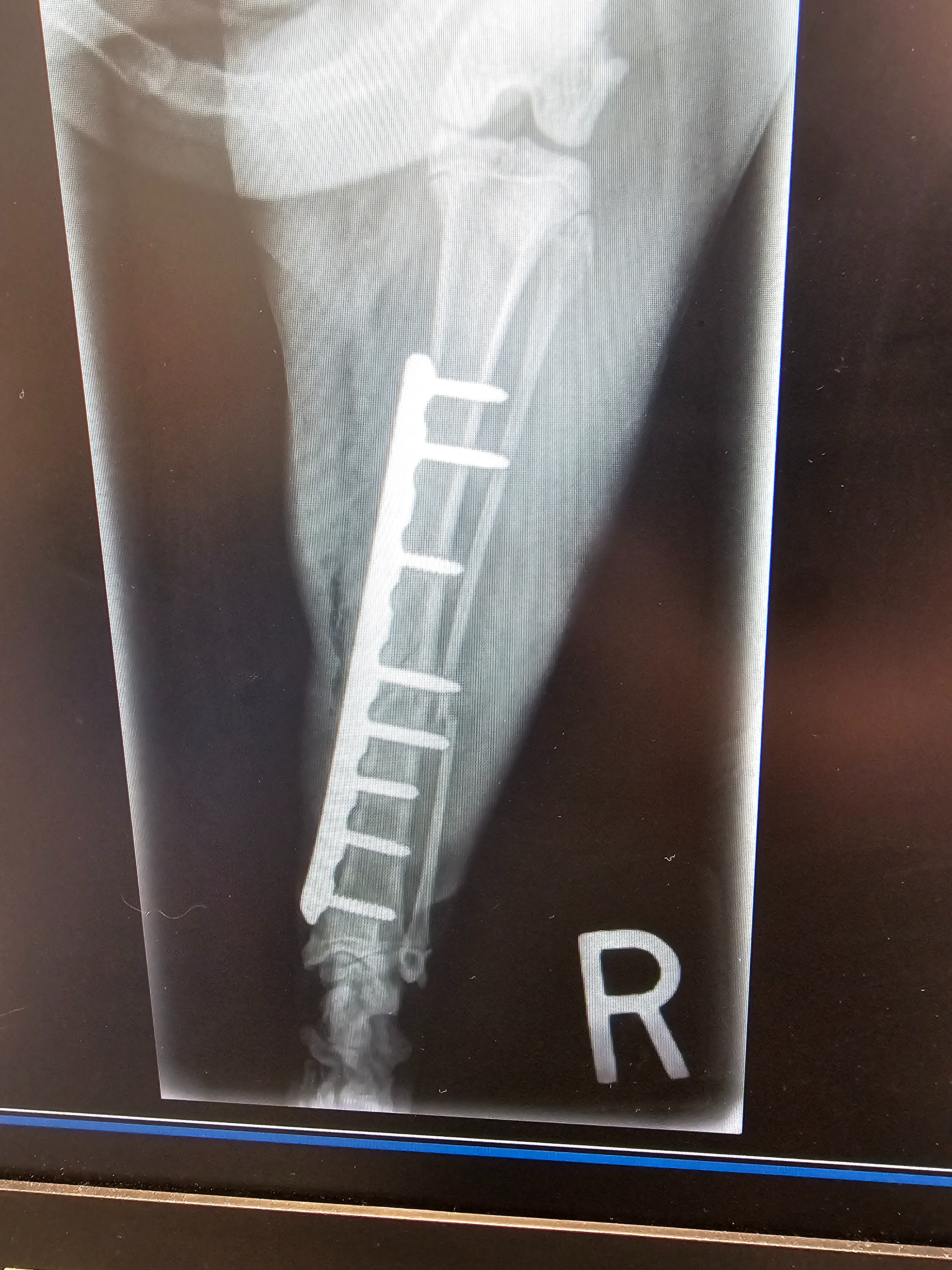 Help Wakka and his humans recover from emergency surgery. campaign photo, 4 of 11