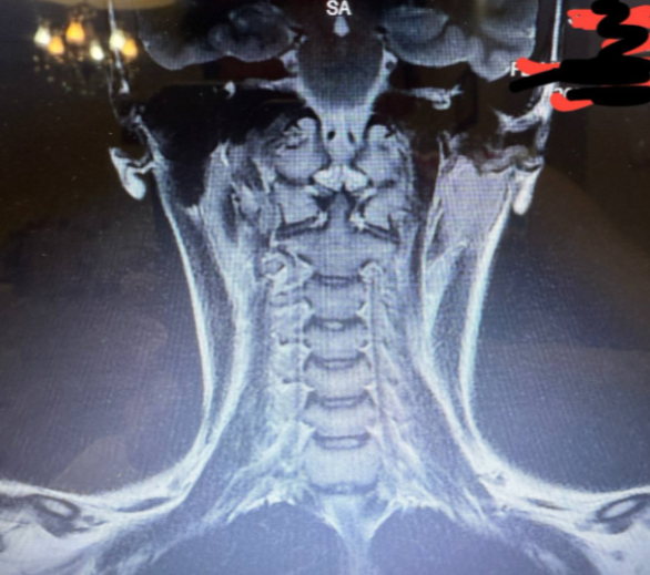 Help Nilla with her Medical bills campaign photo, 2 of 6