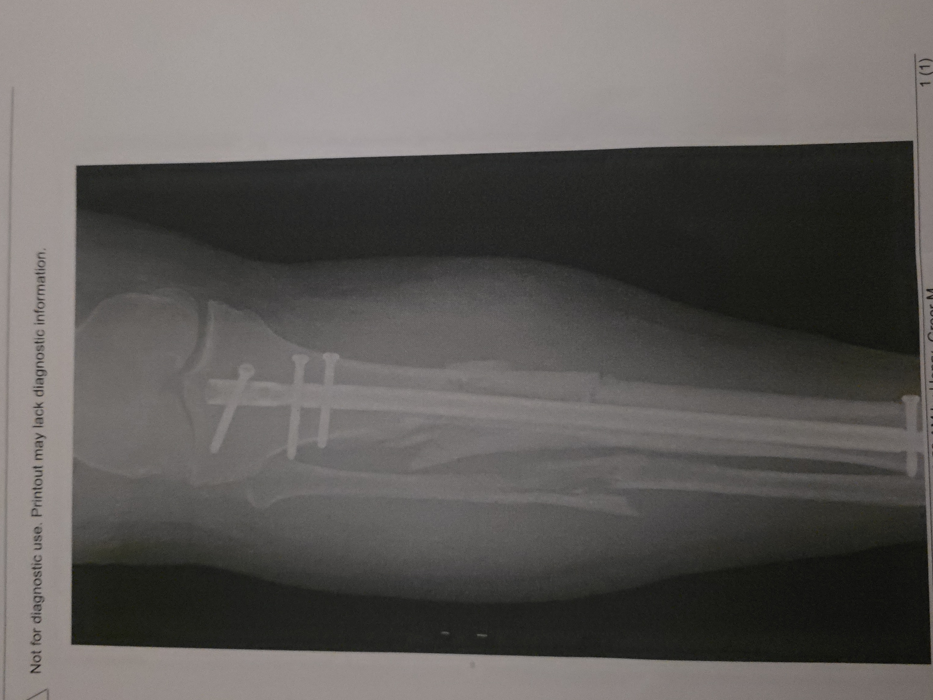 Photo de la campagne Help Kermit get back on His Feet again, 6 sur 11