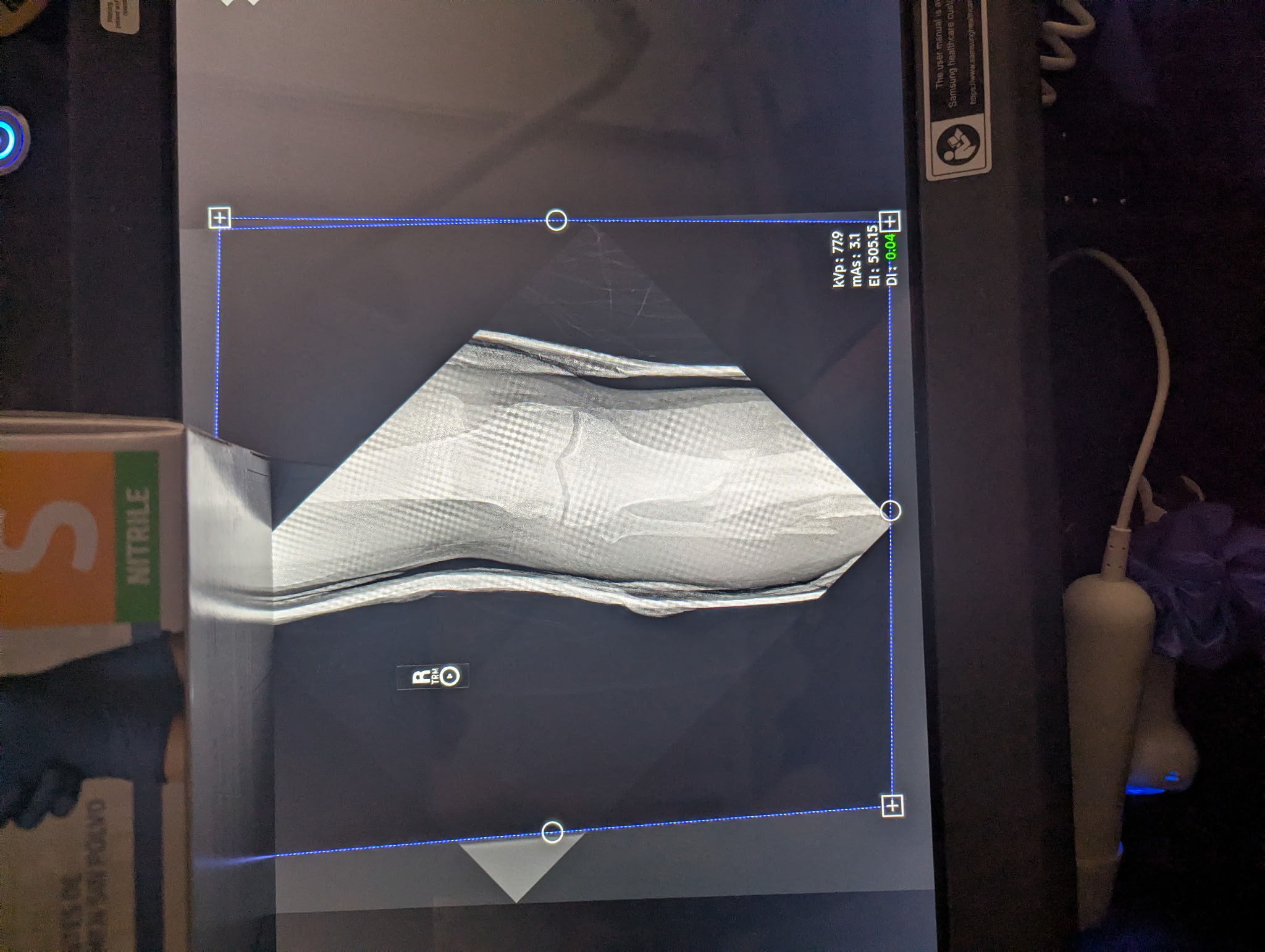 Photo de la campagne Help Kermit get back on His Feet again, 7 sur 11