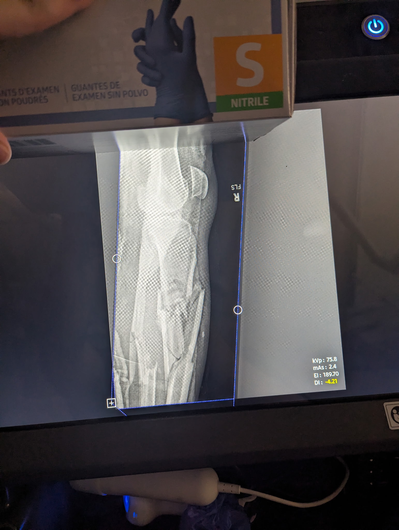 Photo de la campagne Help Kermit get back on His Feet again, 8 sur 11