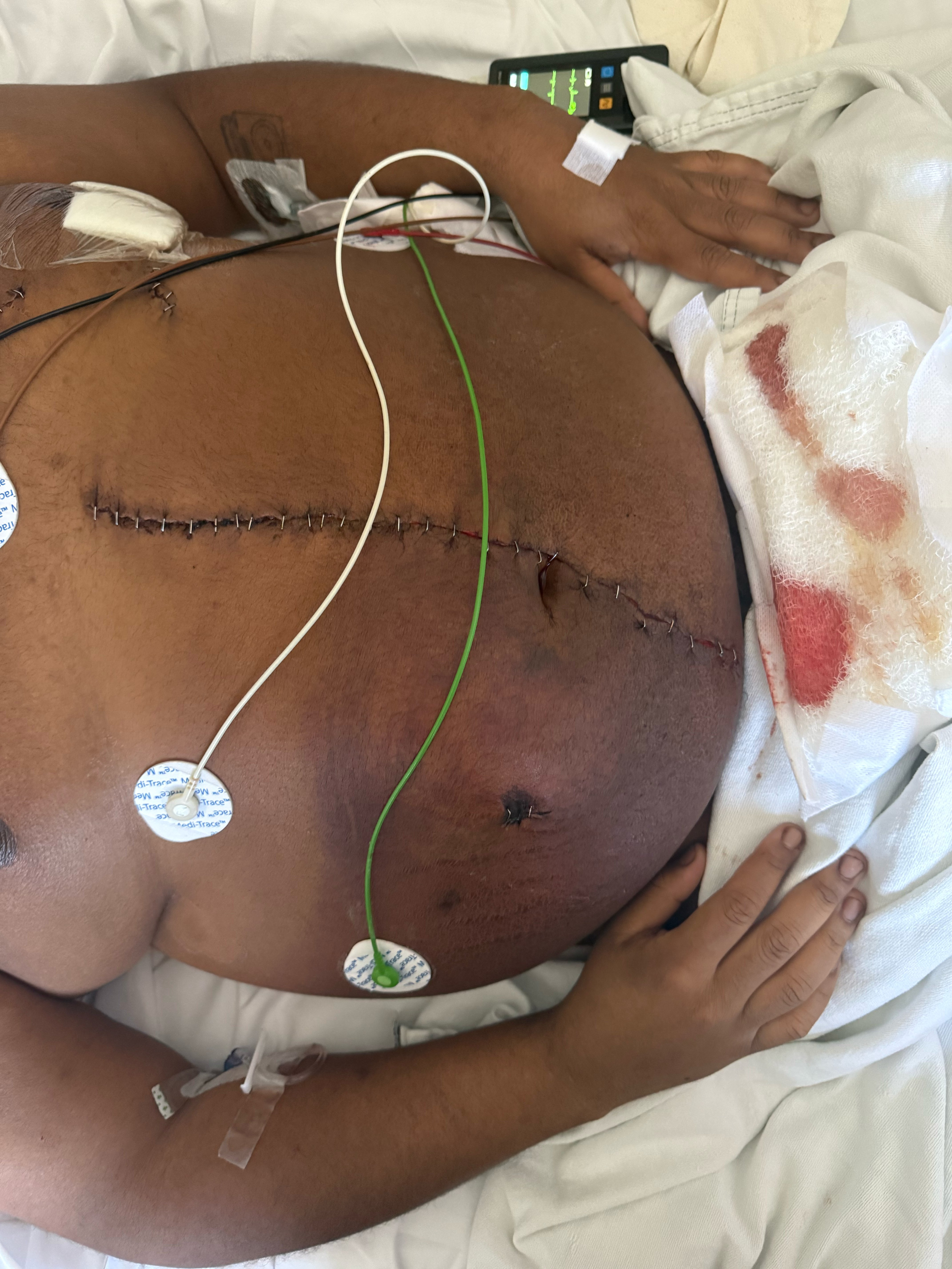 Help Kameron Heal After Violent Attack campaign photo, 4 of 6