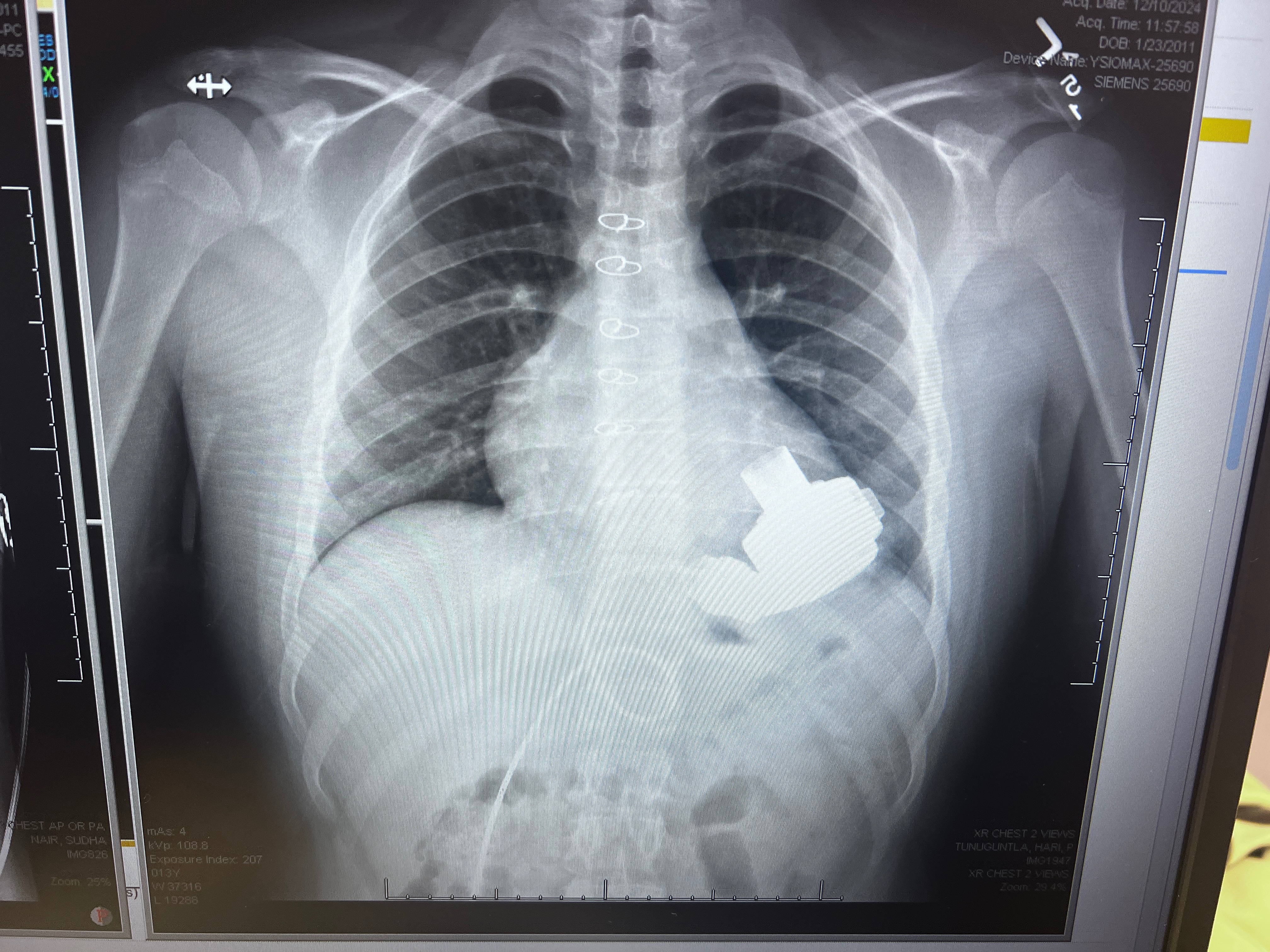 Help with Collin’s heart transplant expenses campaign photo, 10 of 11