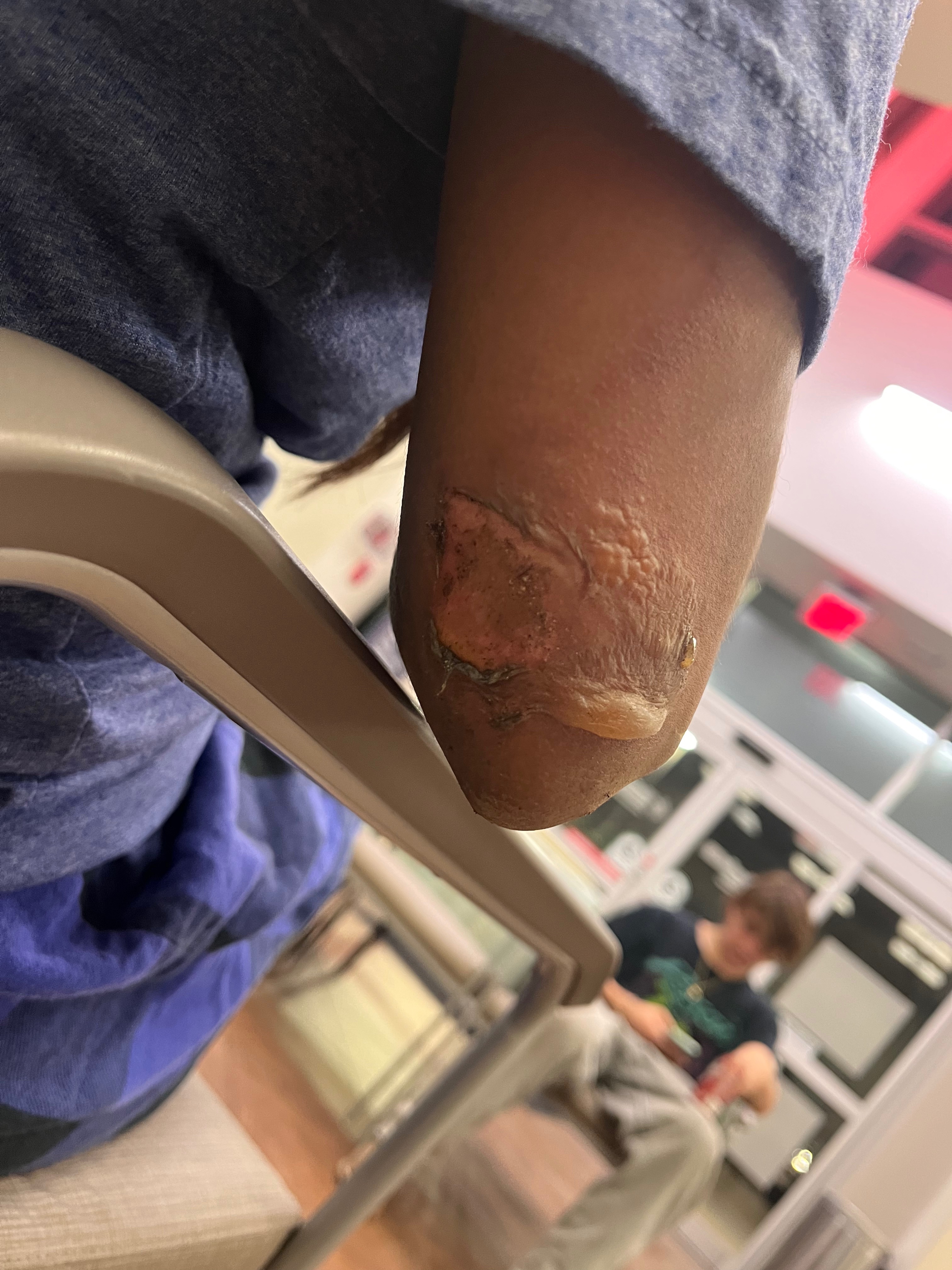 Back on the Road After Hit and Run campaign photo, 5 of 8