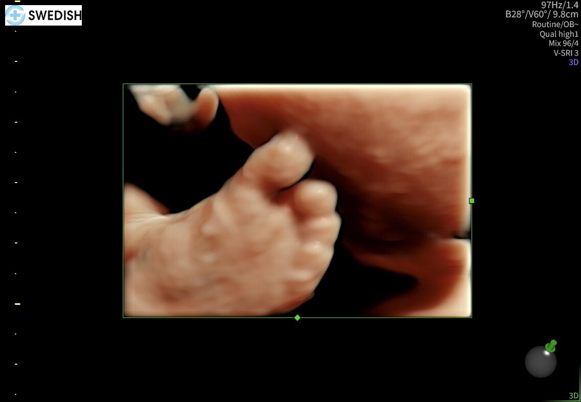 Support Lovely's Birth and Recovery campaign photo, 6 of 7