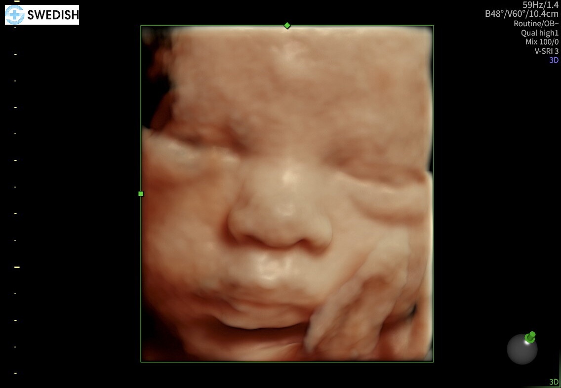 Support Lovely's Birth and Recovery campaign photo, 2 of 7