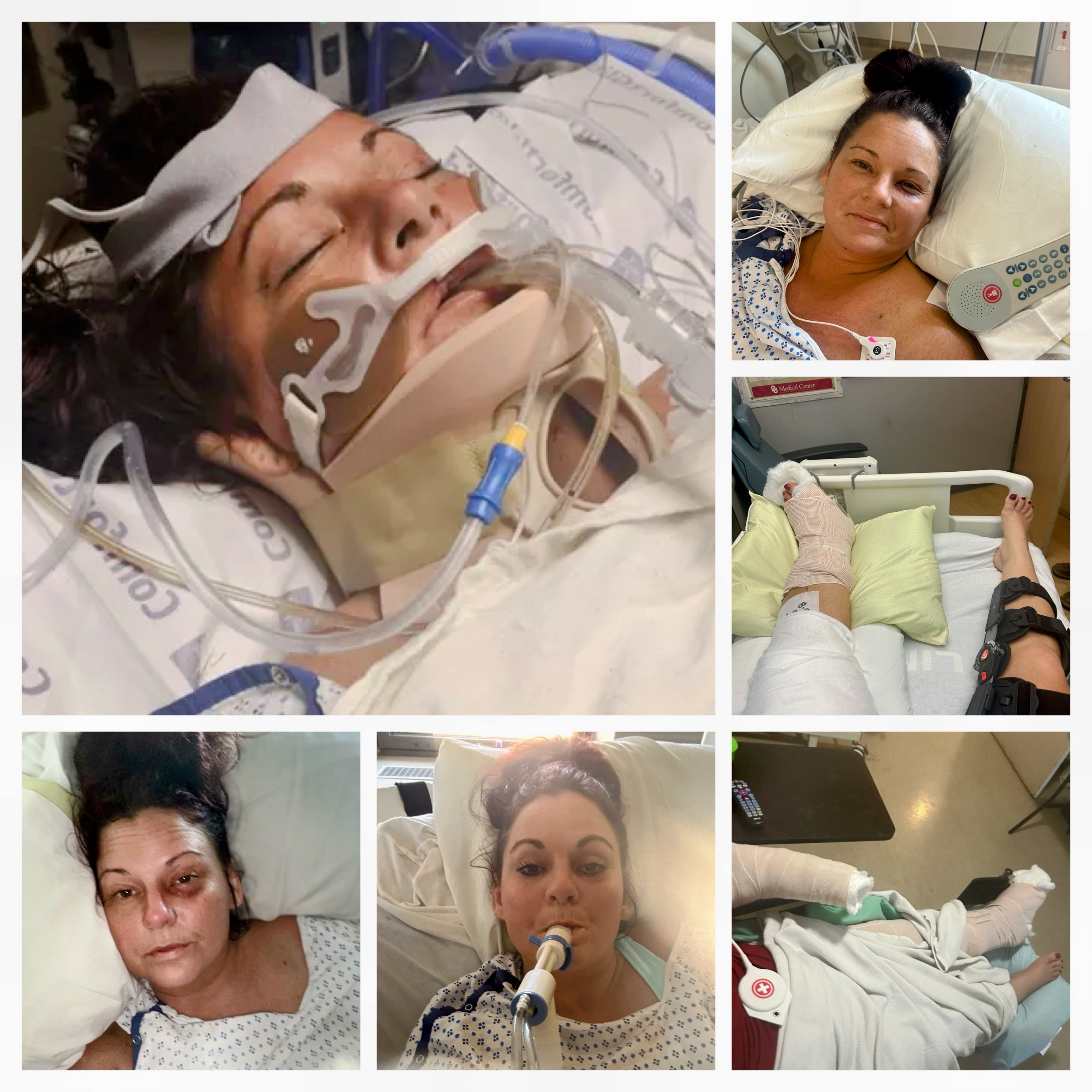 Photo de la campagne Help Mindy Ride and Heal Again, 6 sur 8