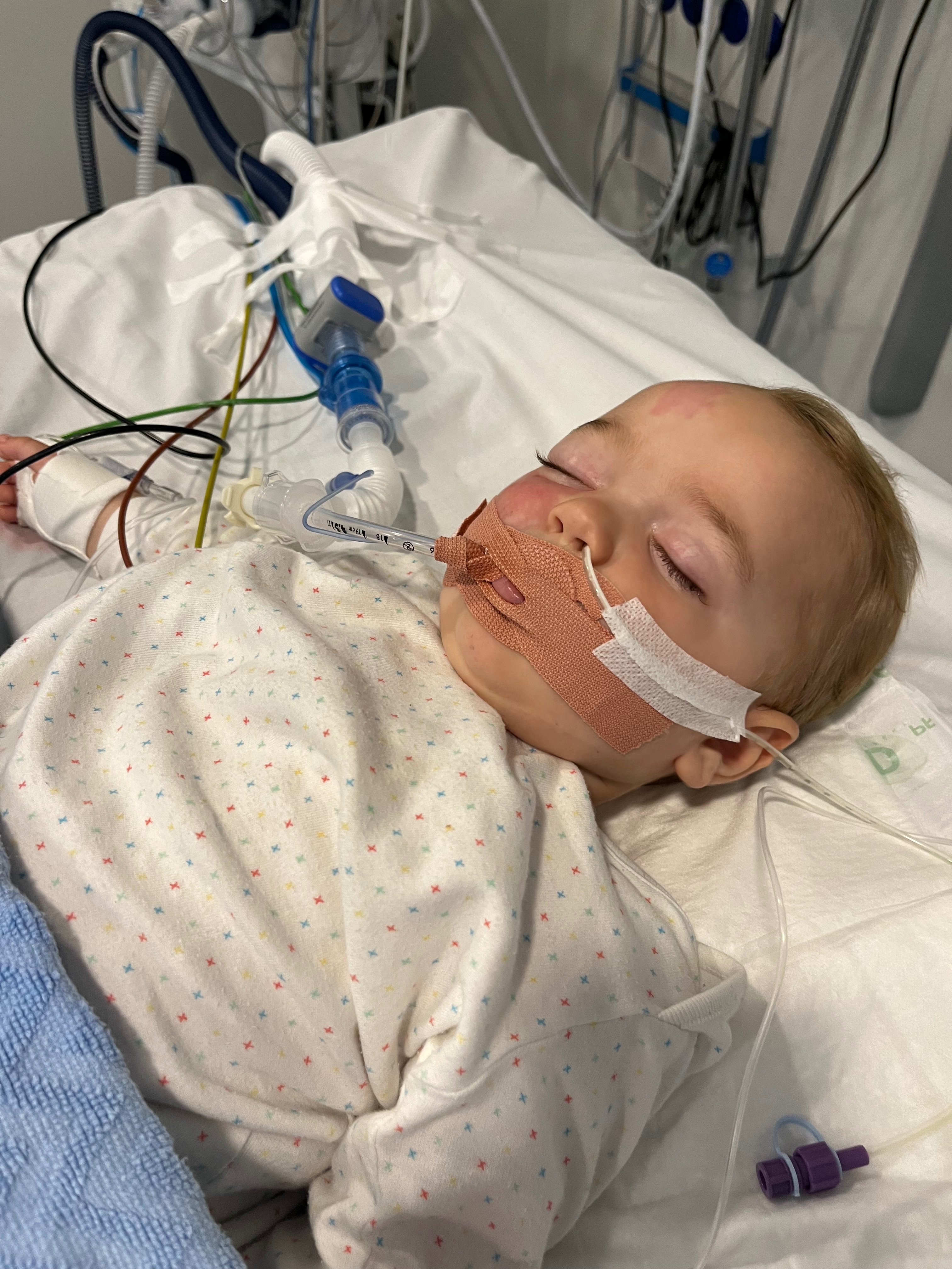 Help Fund a Future Cure for Sturge-Weber Syndrome campaign photo, 4 of 7