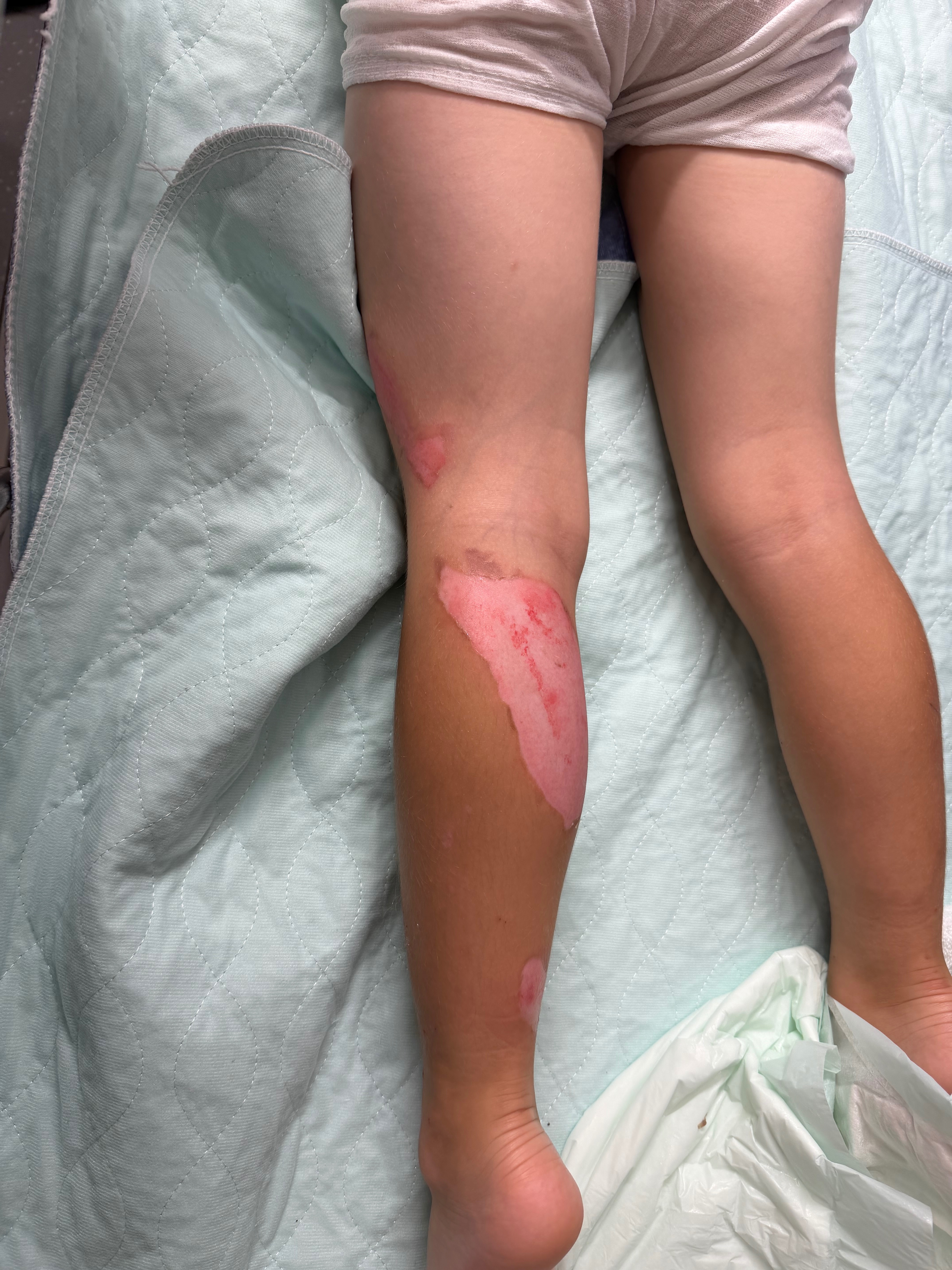 Support Cohen & Family after accident campaign photo, 5 of 8