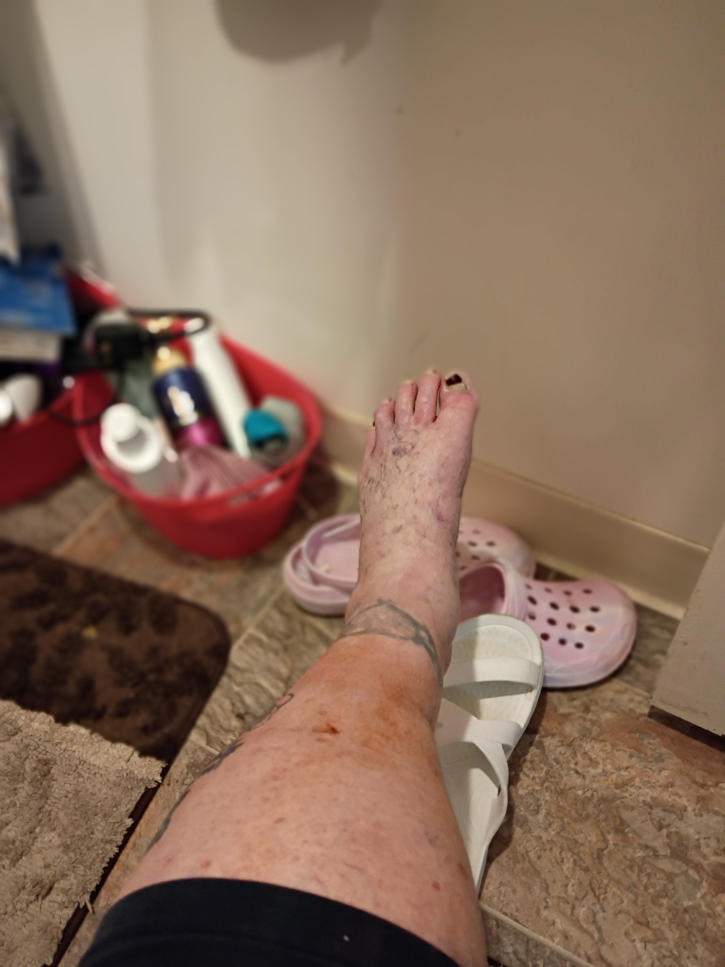 Help Me Through Illness campaign photo, 4 of 5