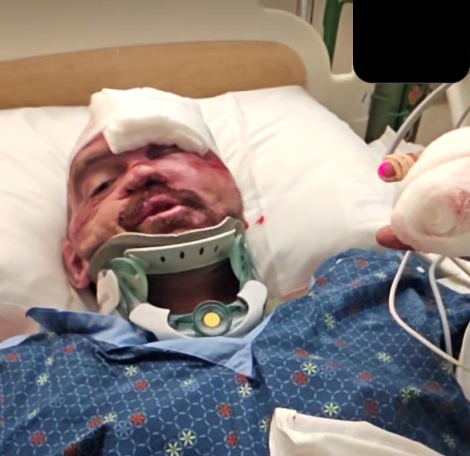 Support Lance After Hit and Run campaign photo, 4 of 5