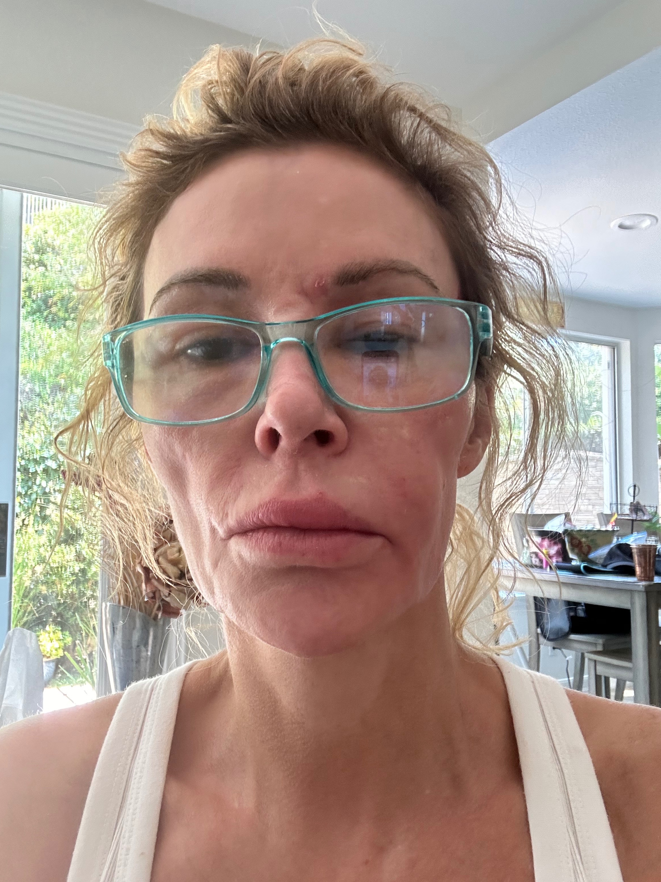 Standing with Brandi Glanville Through Her Treatment campaign photo, 6 of 8