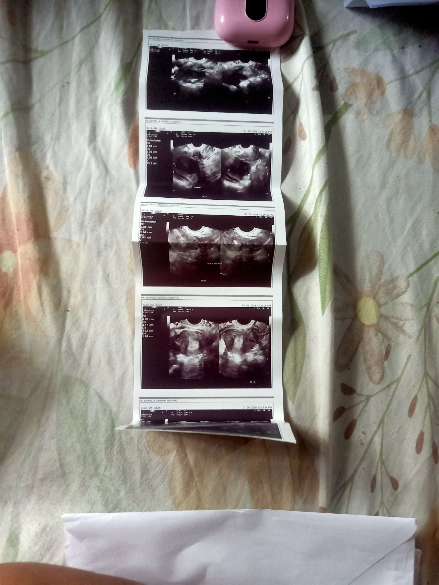 Support Julia's Surgeries and Ongoing Care campaign photo, 6 of 8